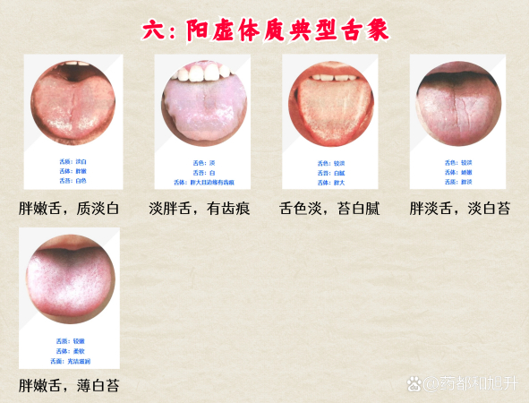 分享最全高清舌诊,看舌头知健康,堪比教科书,必须收藏!