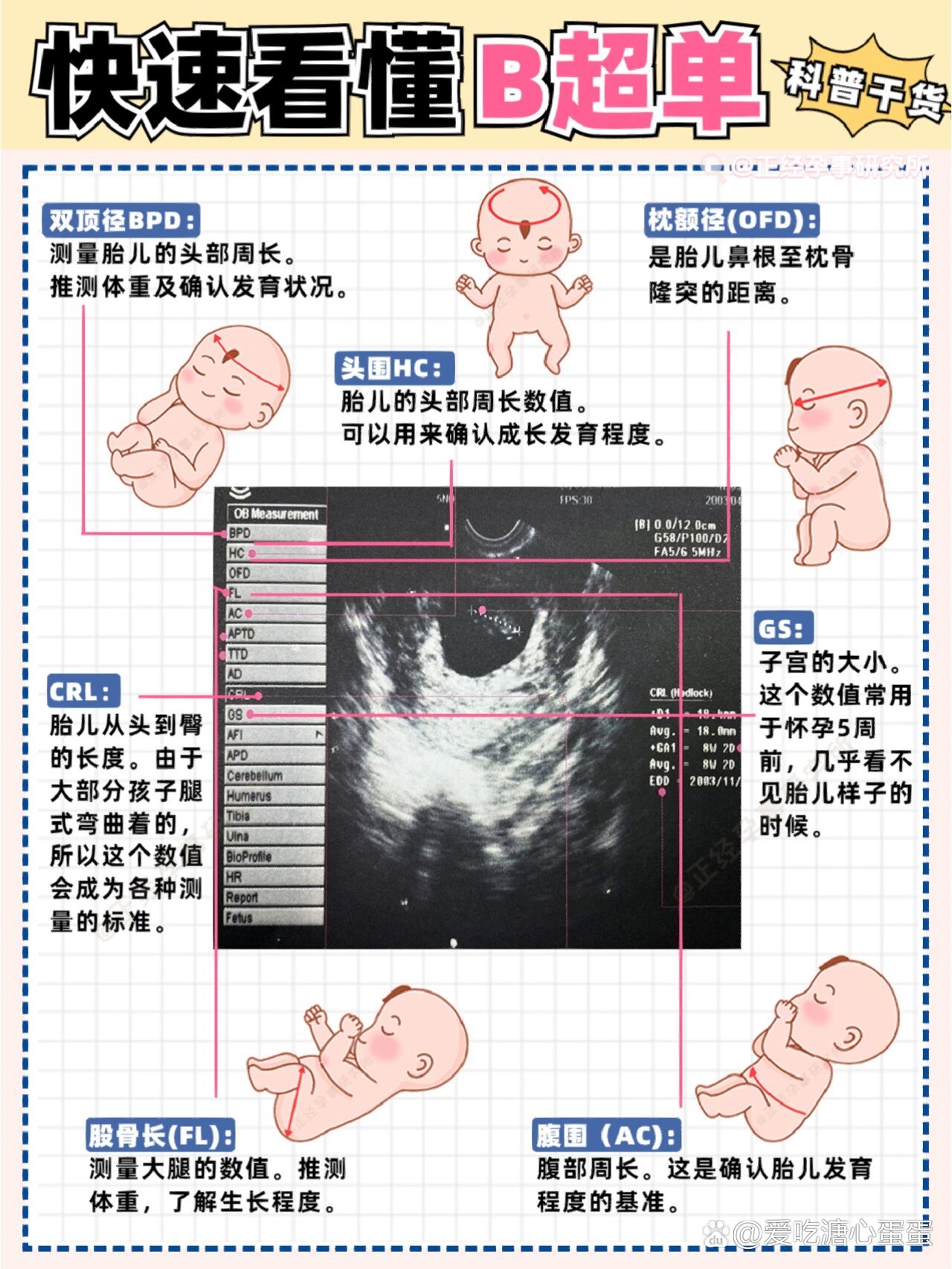快速看懂孕检b超单
