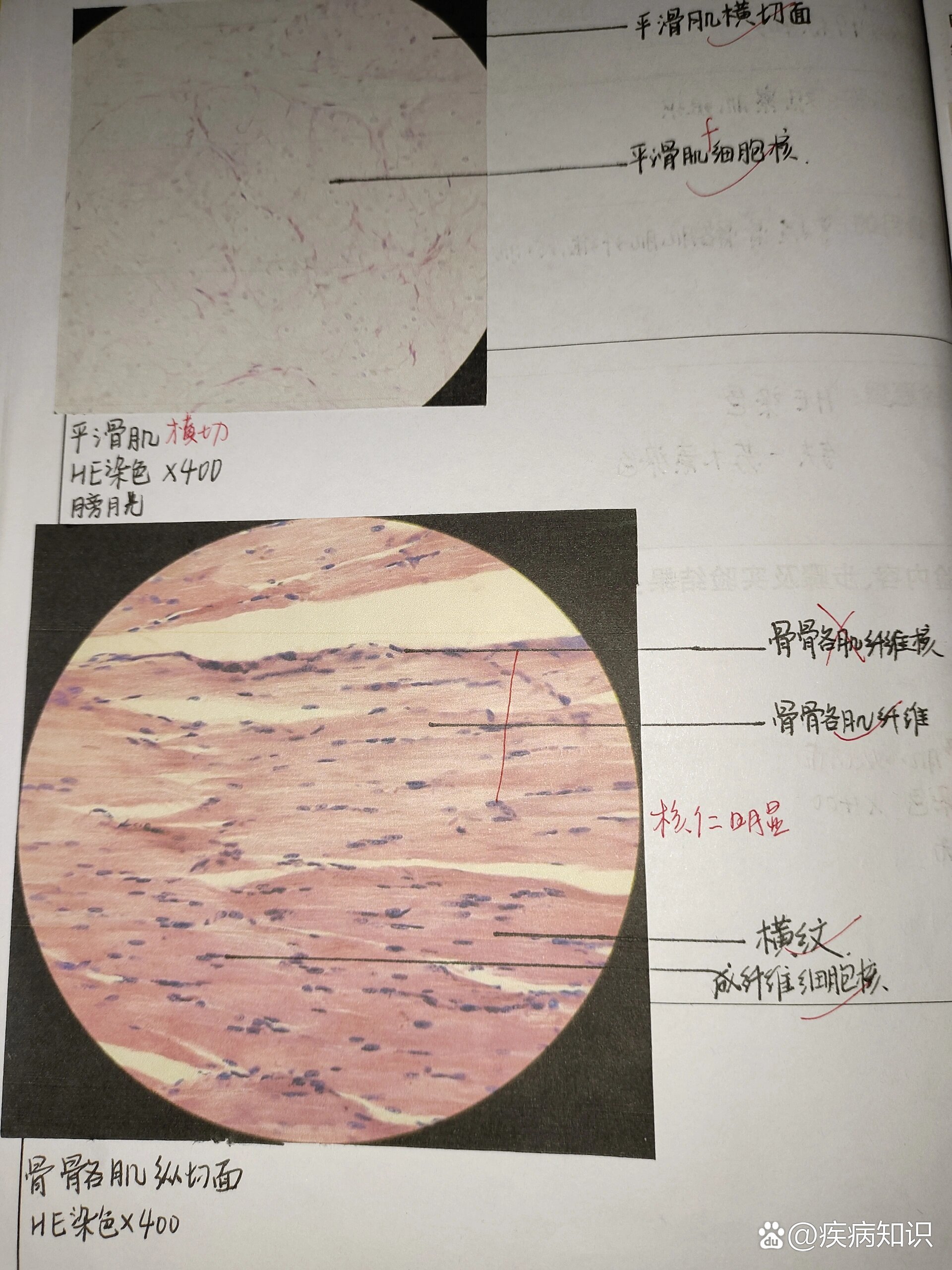 心肌的闰盘,心肌闰盘_文秘苑图库