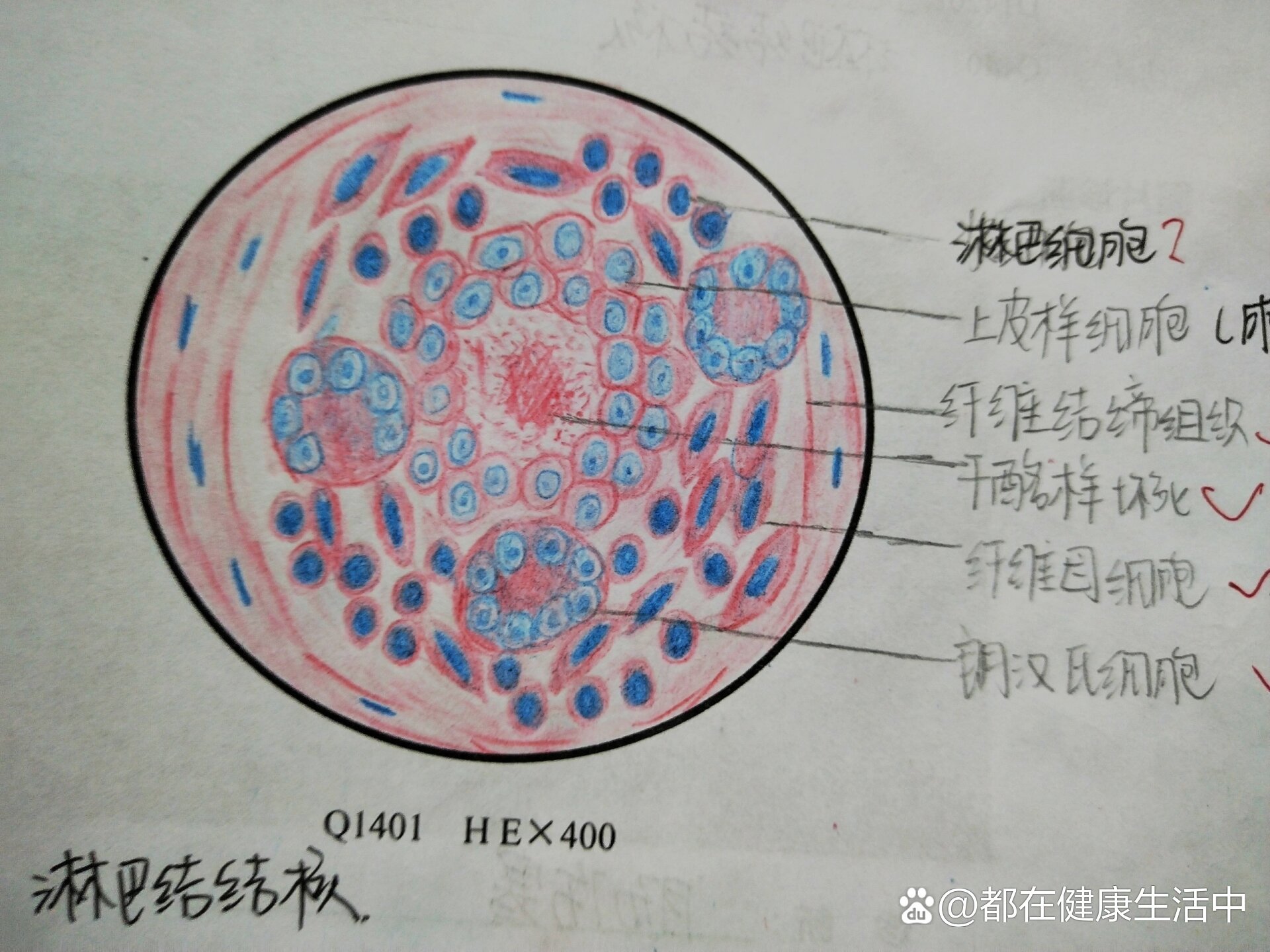 淋巴结结构简图手绘图图片