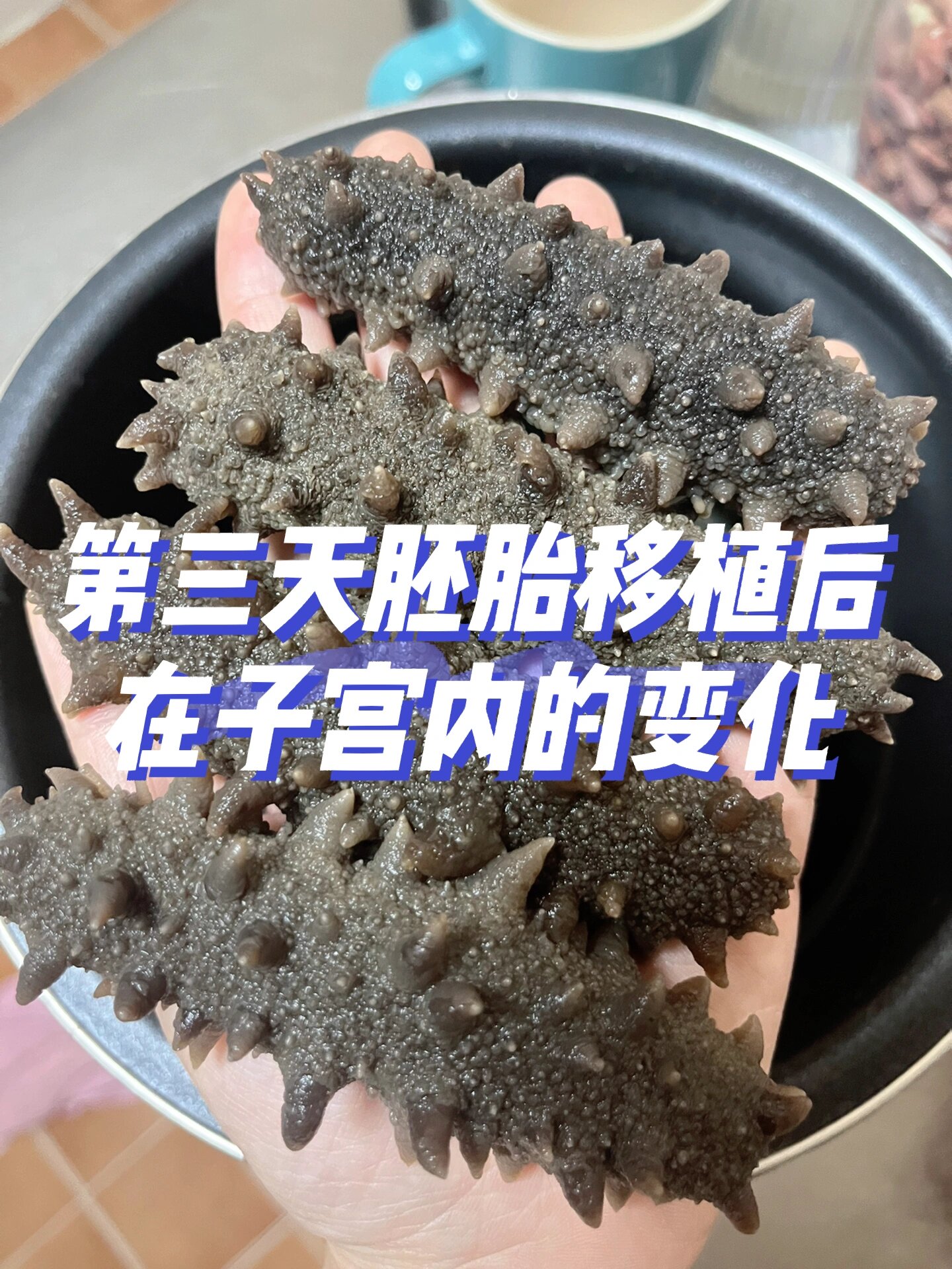 试管移植第三天胚胎图图片