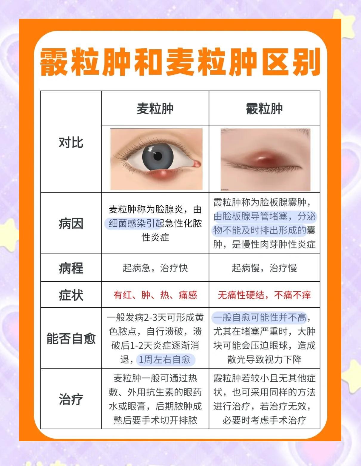 霰粒肿和麦粒肿的区别与治疗指南