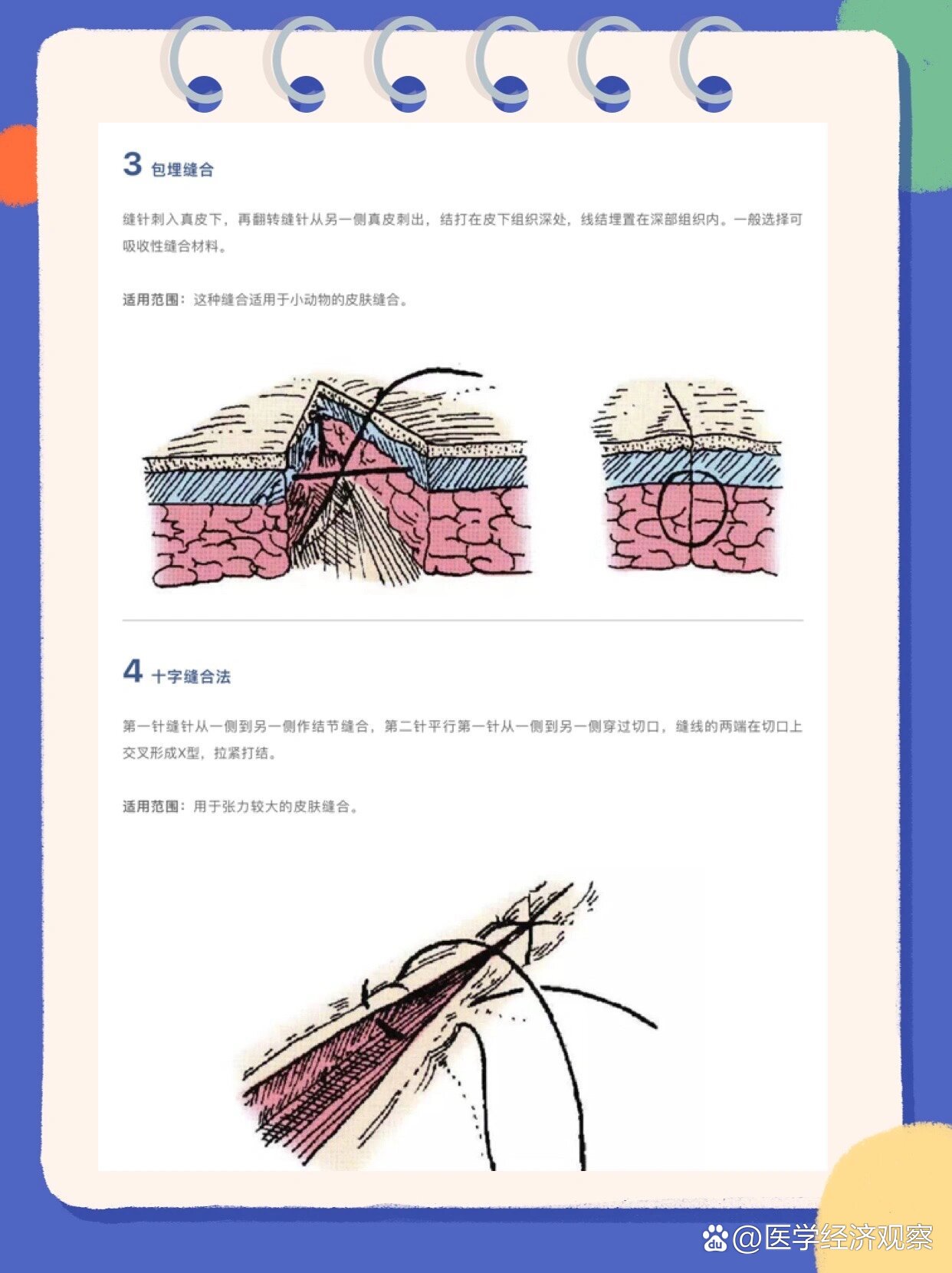 13种外科缝合方法