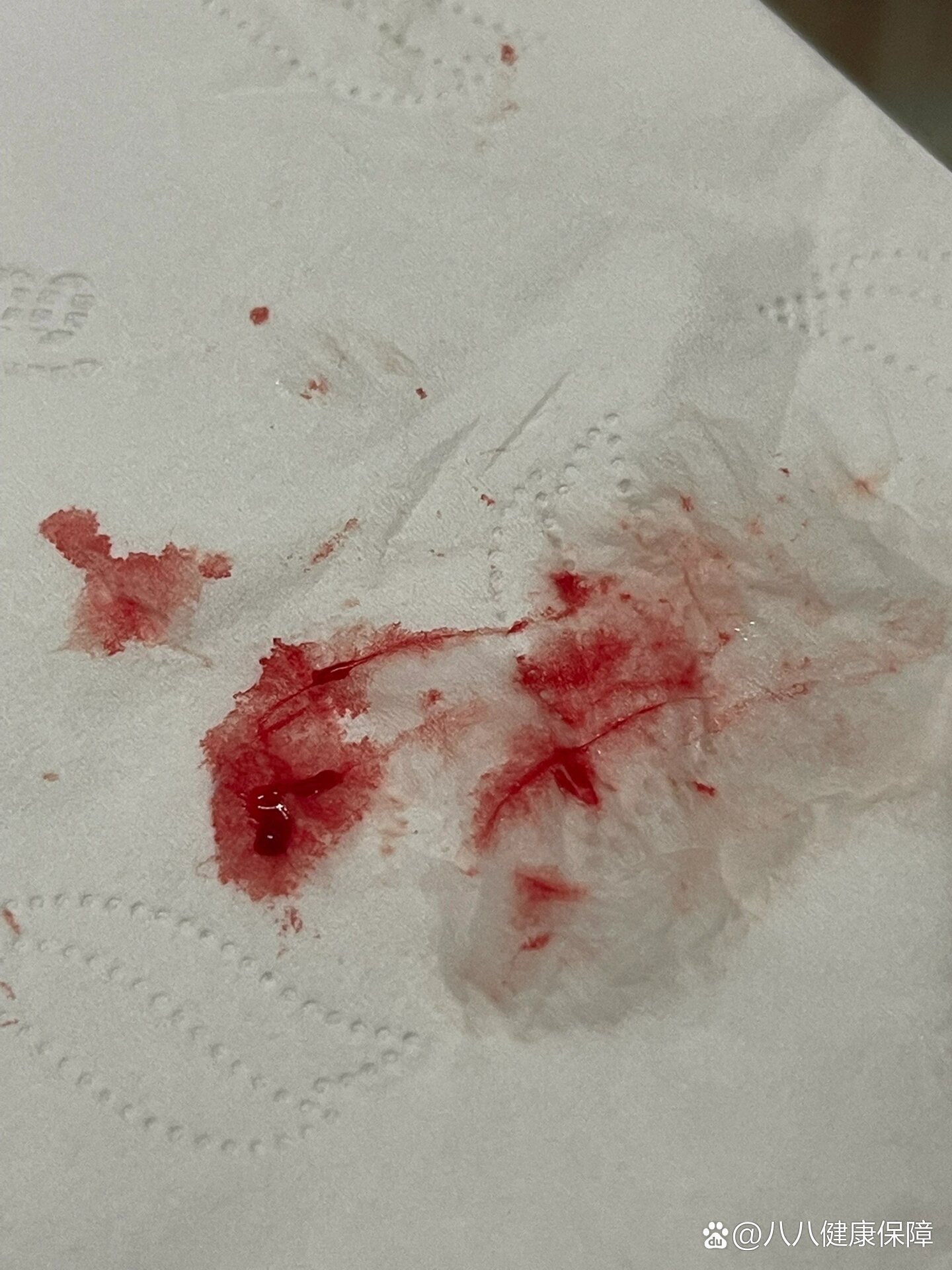 都咳出血了,怎么办