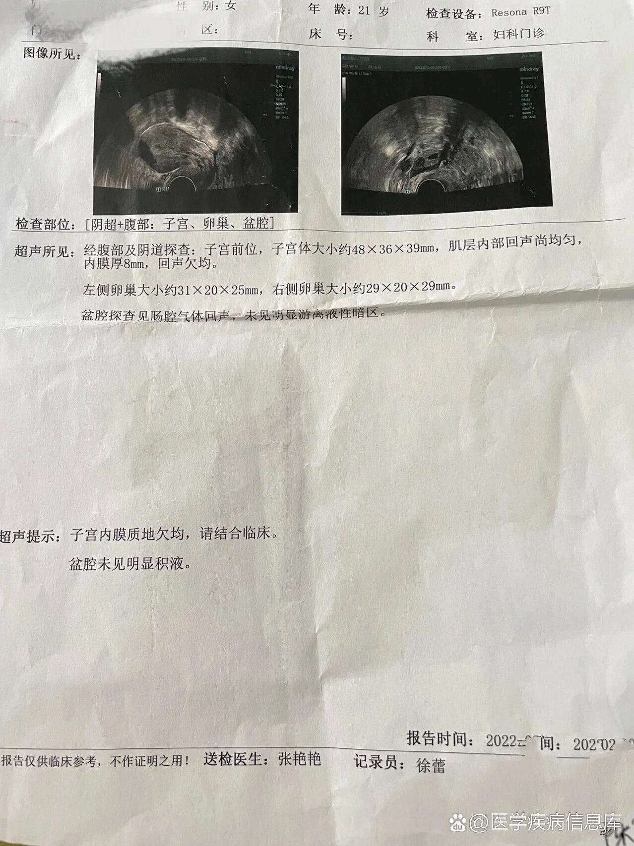 子宫出血血崩一个月