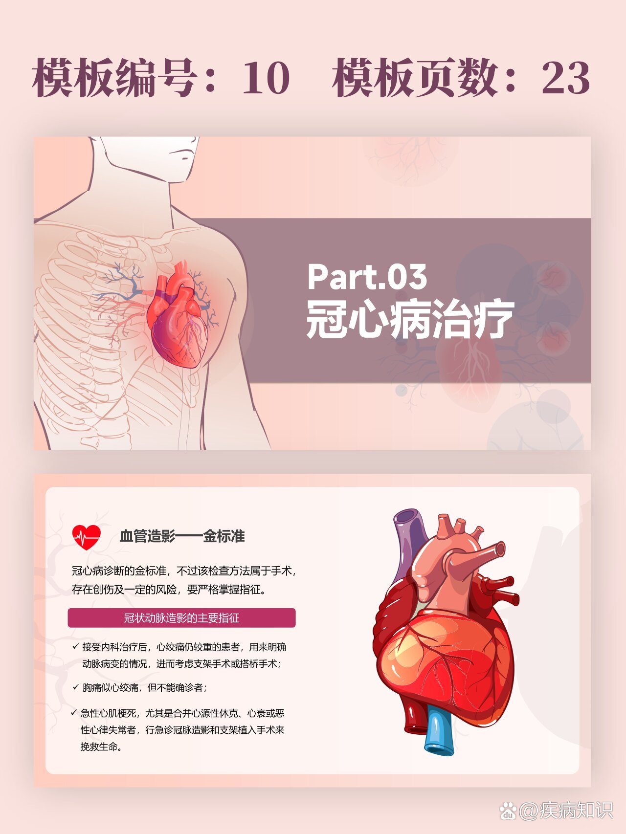冠心病健康教育ppt模板