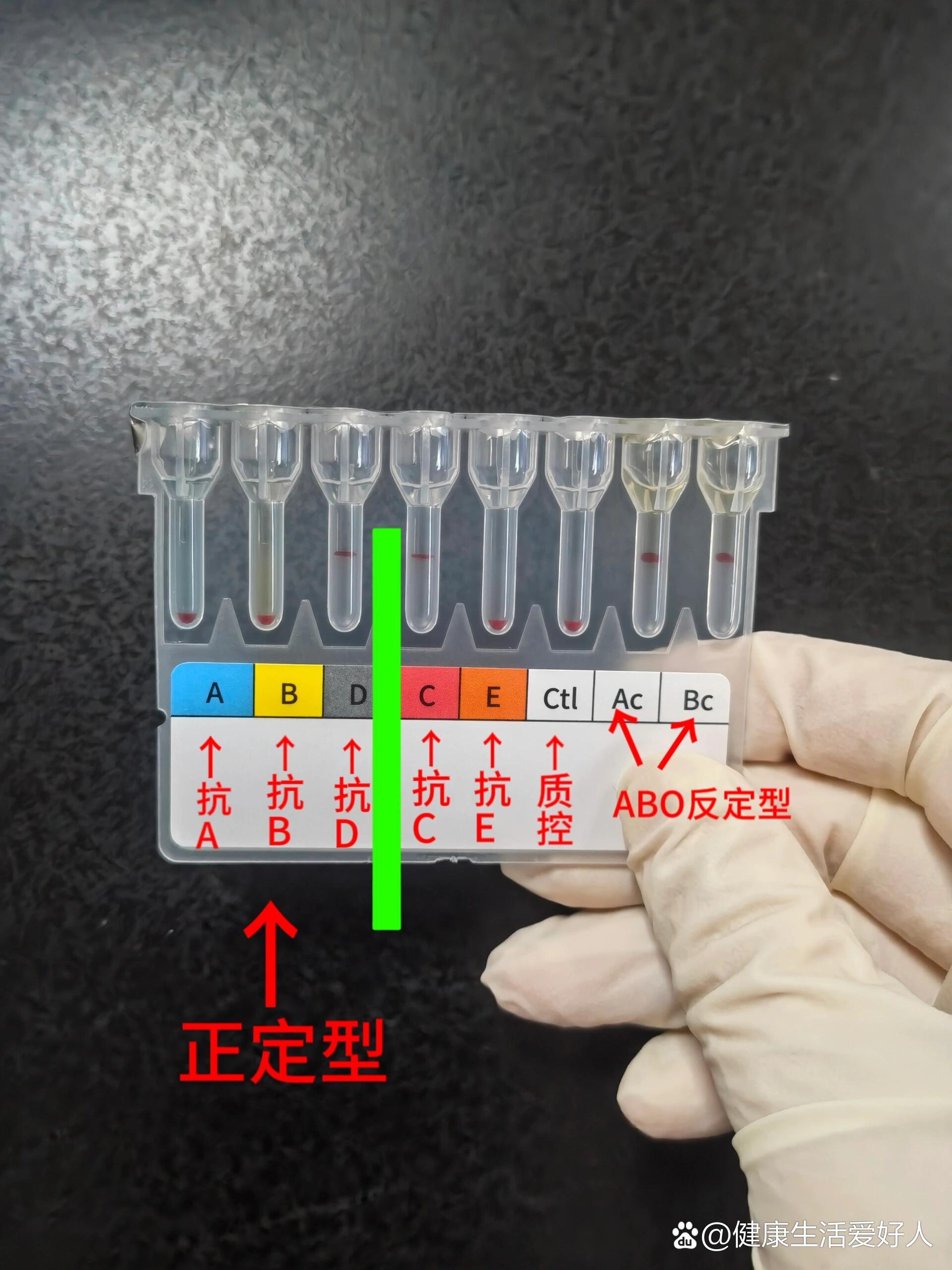 微柱凝胶法图片