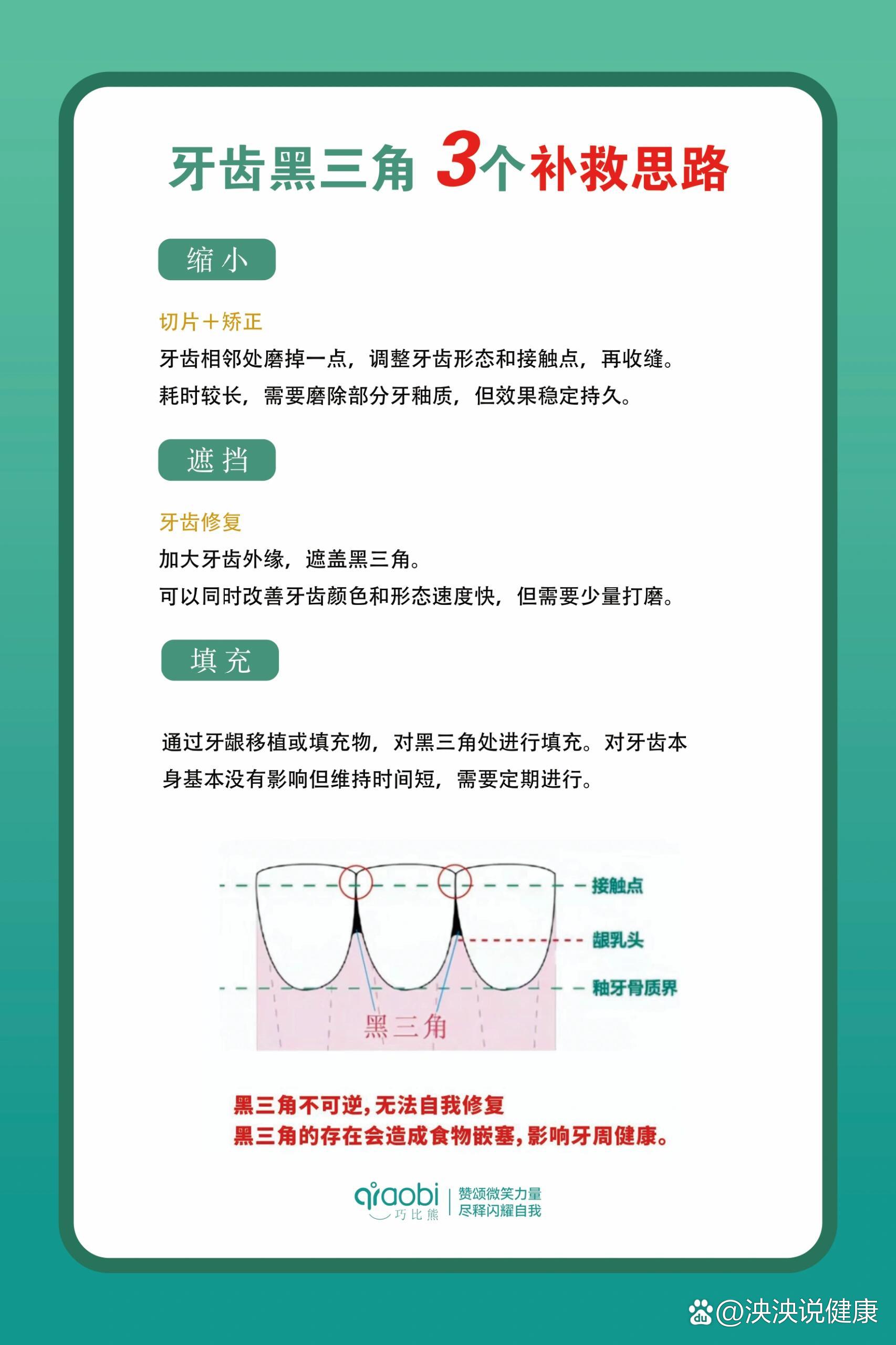 牙齿黑三角3个补救思路