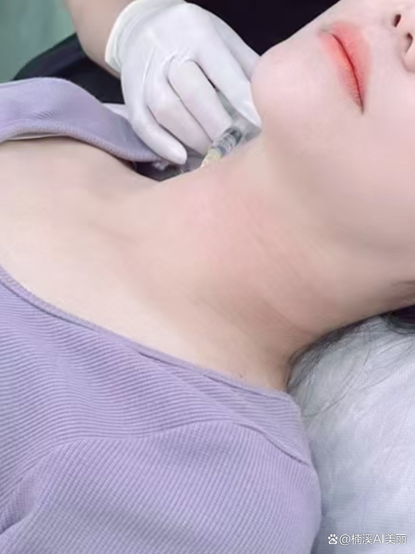 打除皱针的图片,打除皱有哪些后遗症