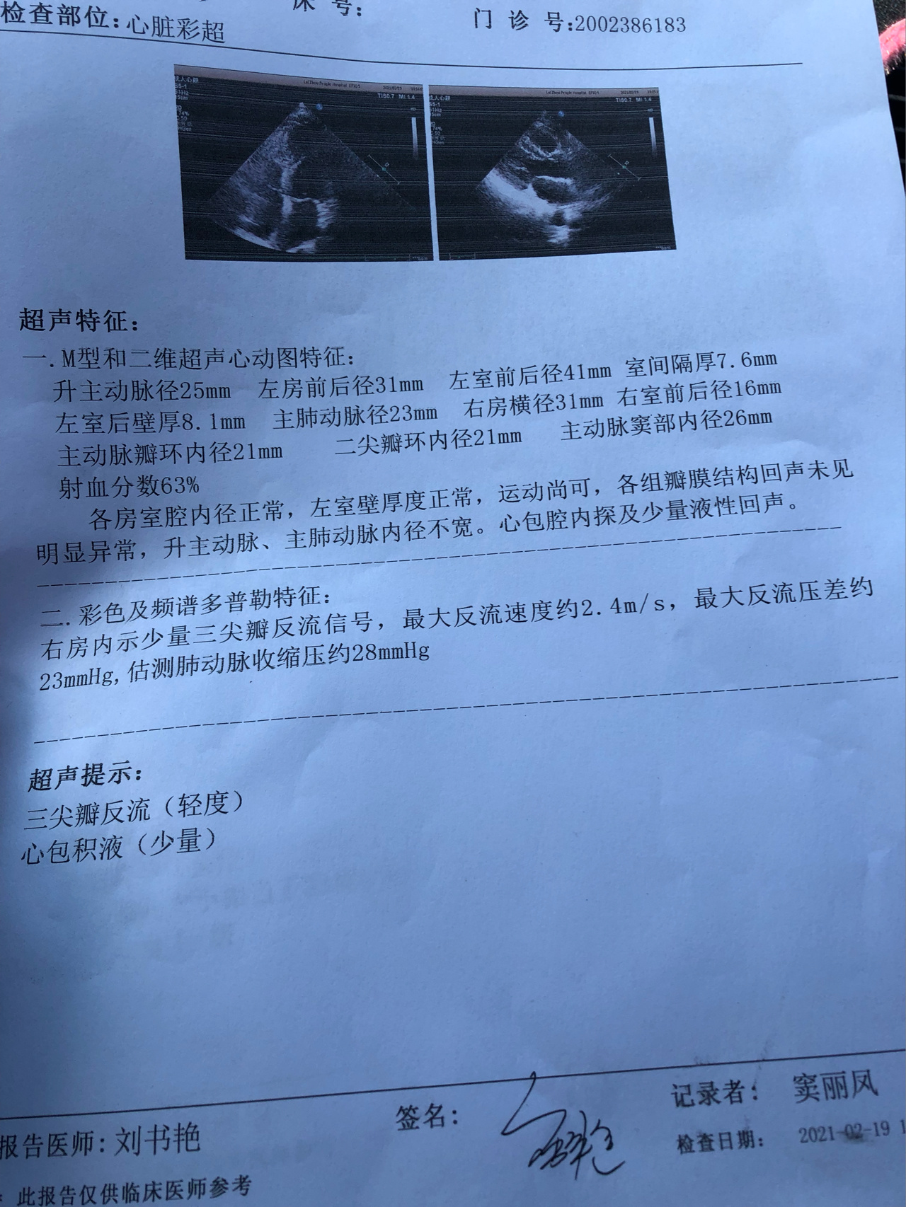 心包积液超声报告图片