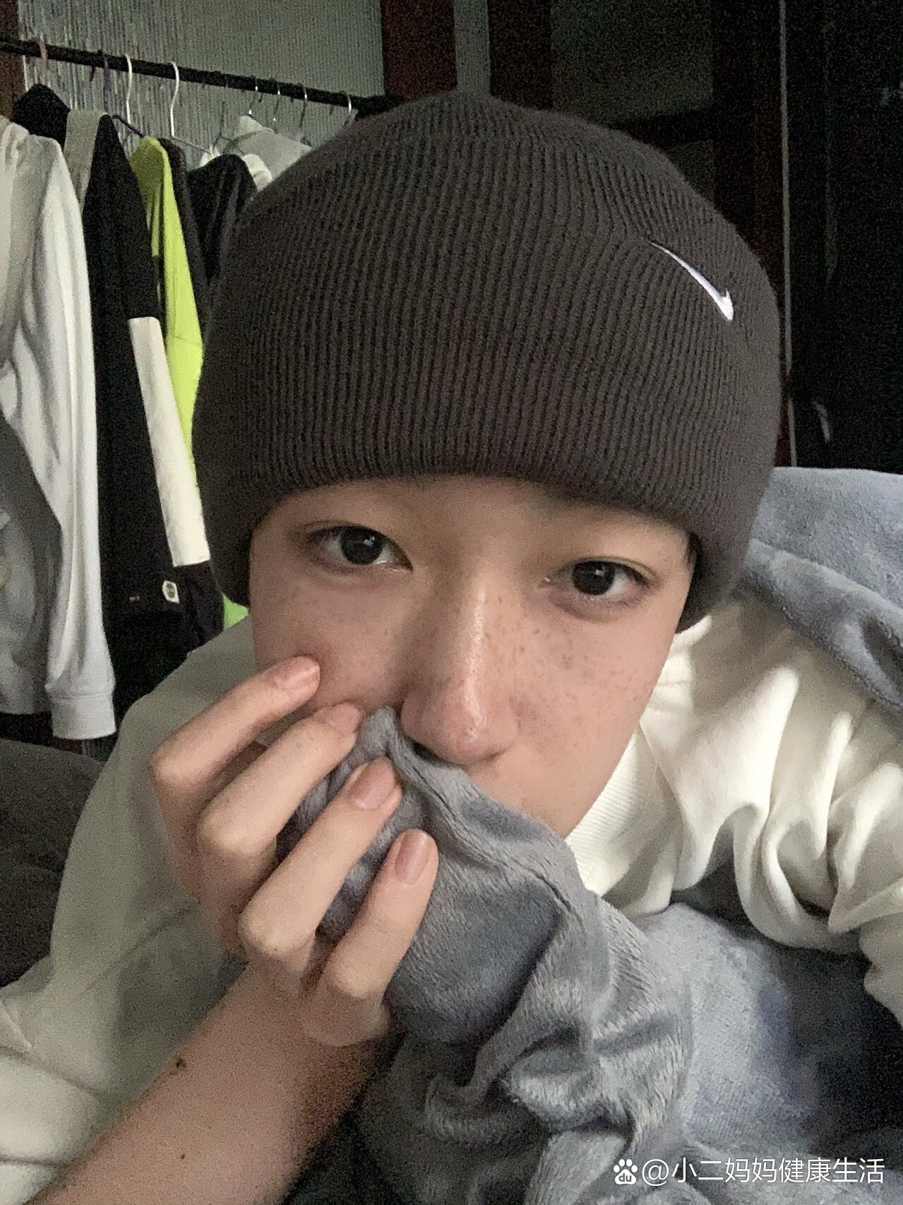 满脸麻子