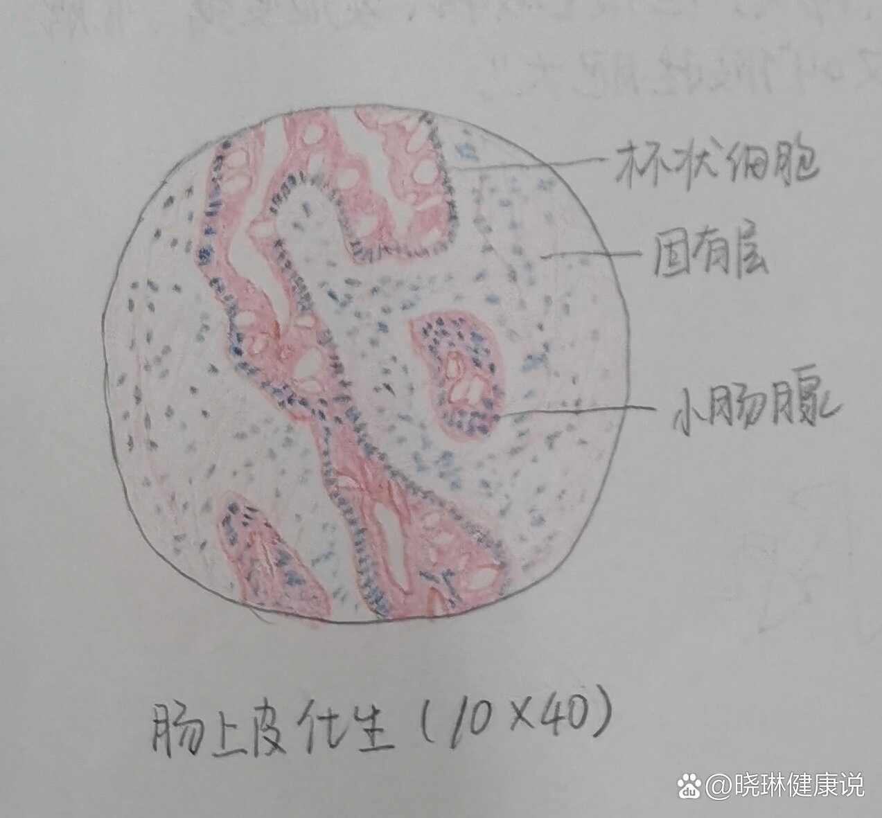 肠上皮化生红蓝铅笔图片