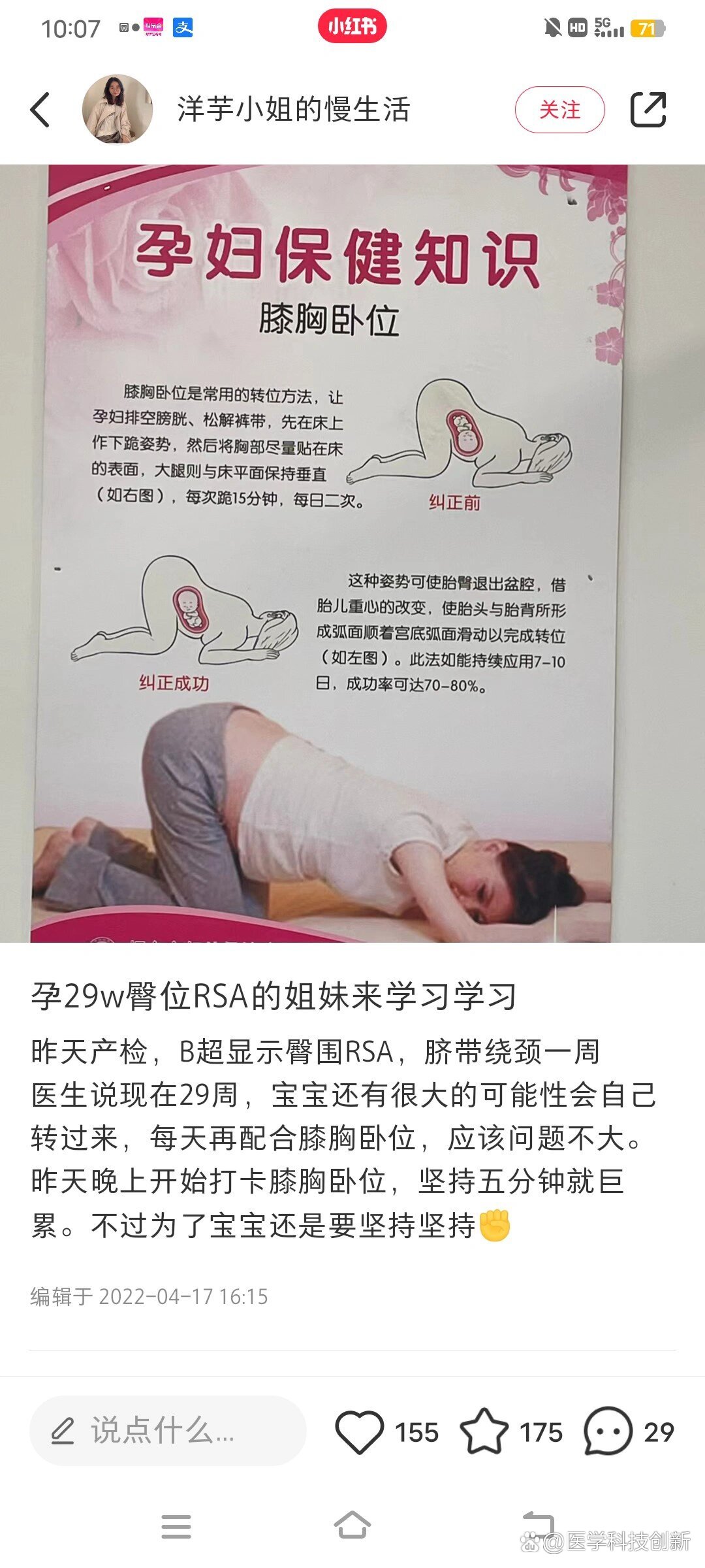 孕妇屈膝卧位姿势图片图片