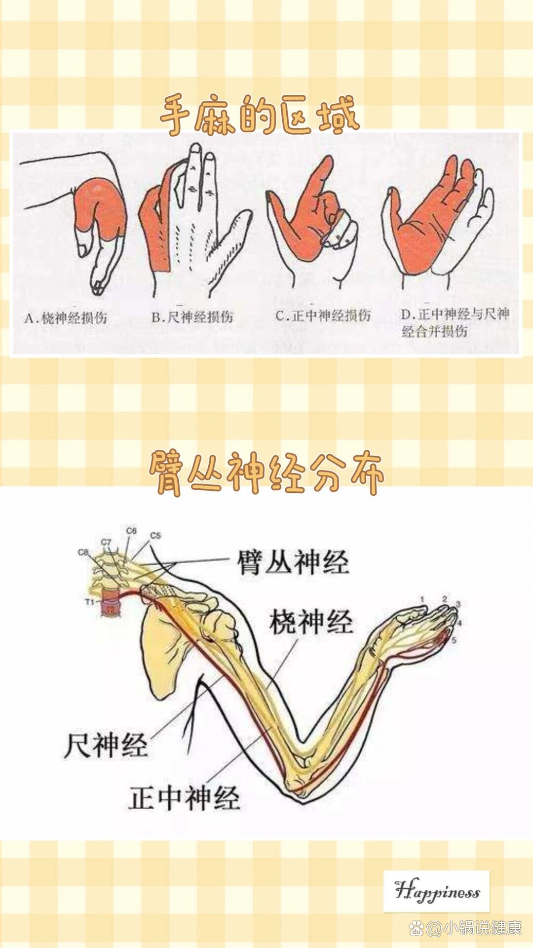 正中神经压迫手发麻图片