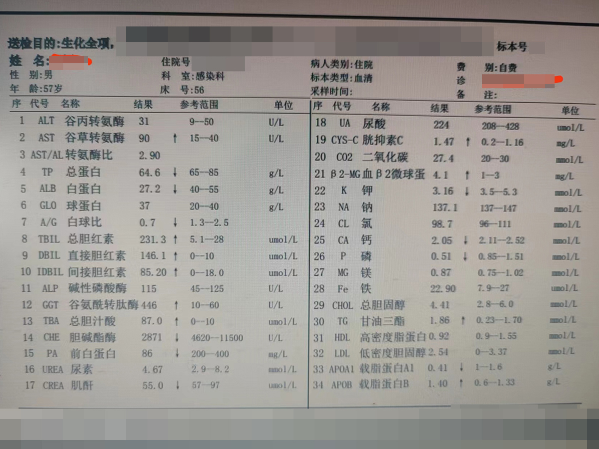 57岁大叔眼黄尿黄诊断酒精性肝病，药物治疗得以好转（医院名称打码）.jpg