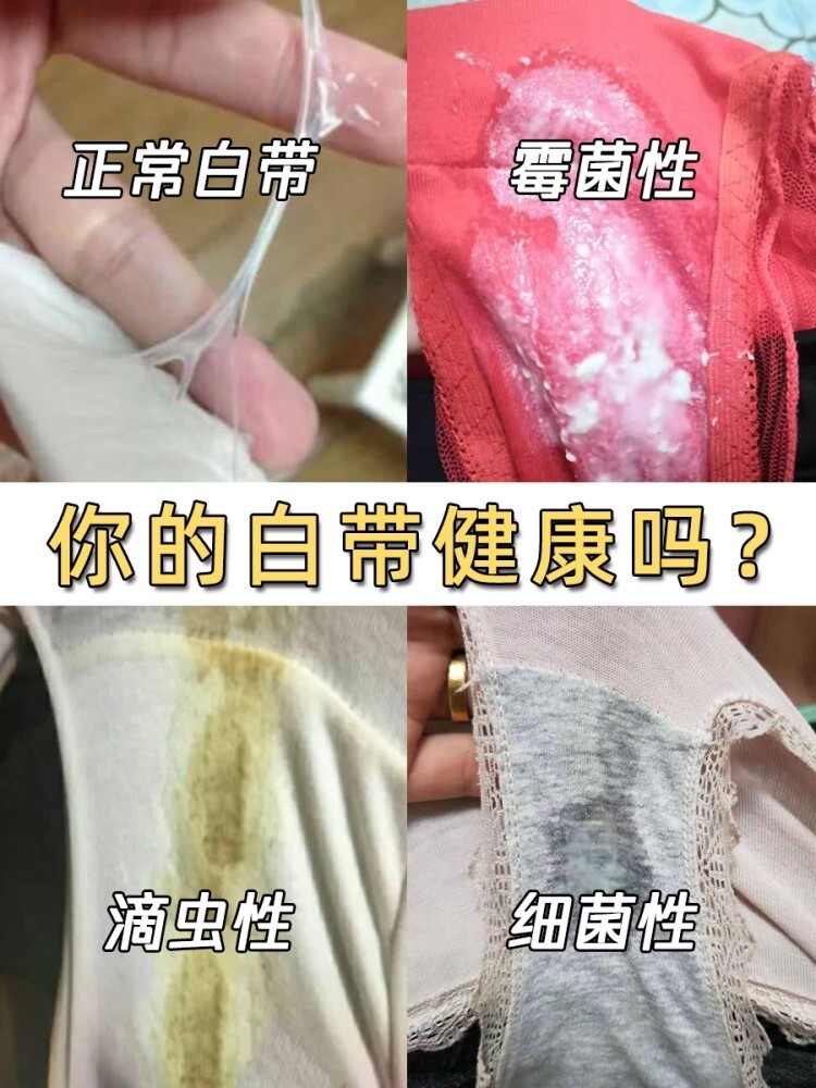 白带是什么样子才正常图片