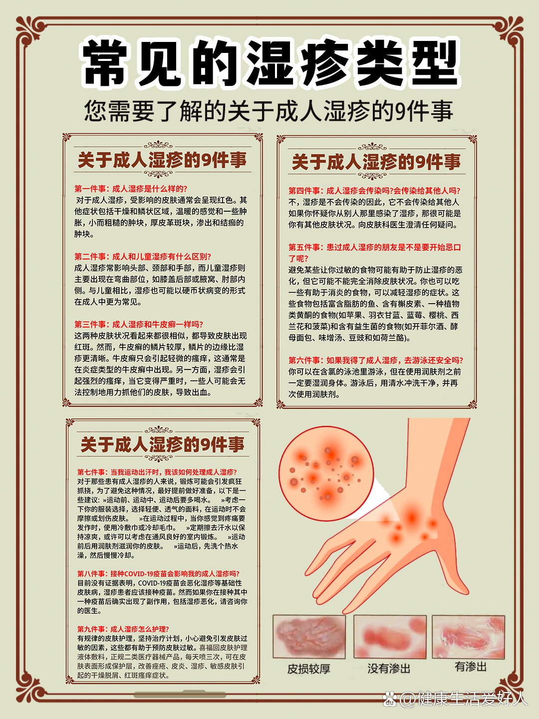 您需要了解关于成人湿疹9件事,建议收藏!