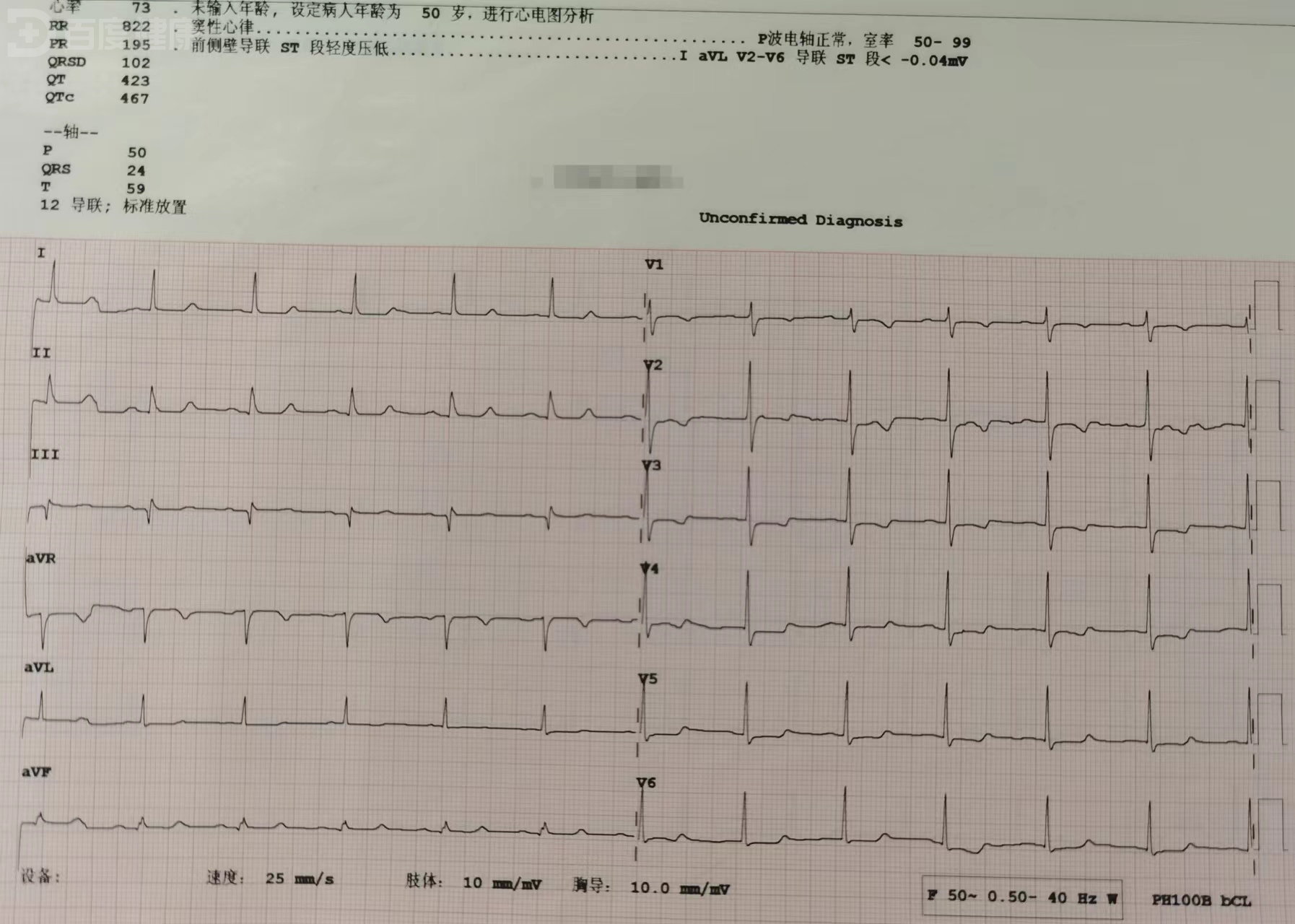 心肌桥莫慌张,对症治疗就可以