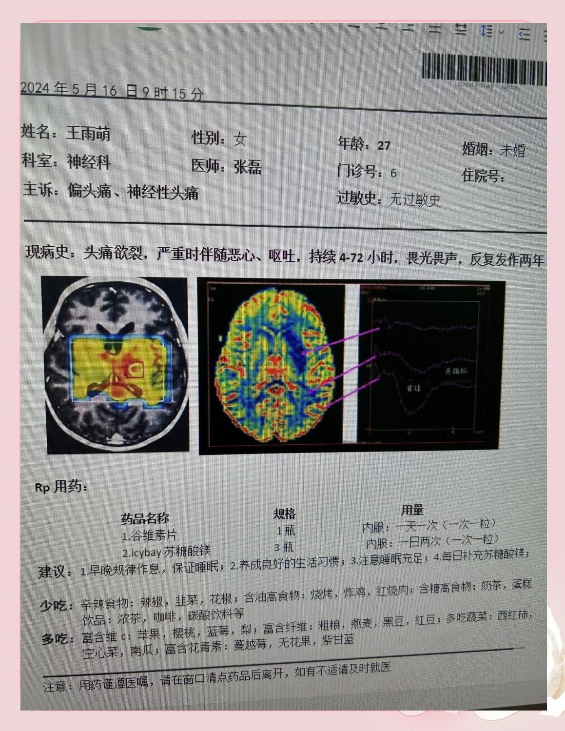 偏头痛的五大诱因及缓解方法