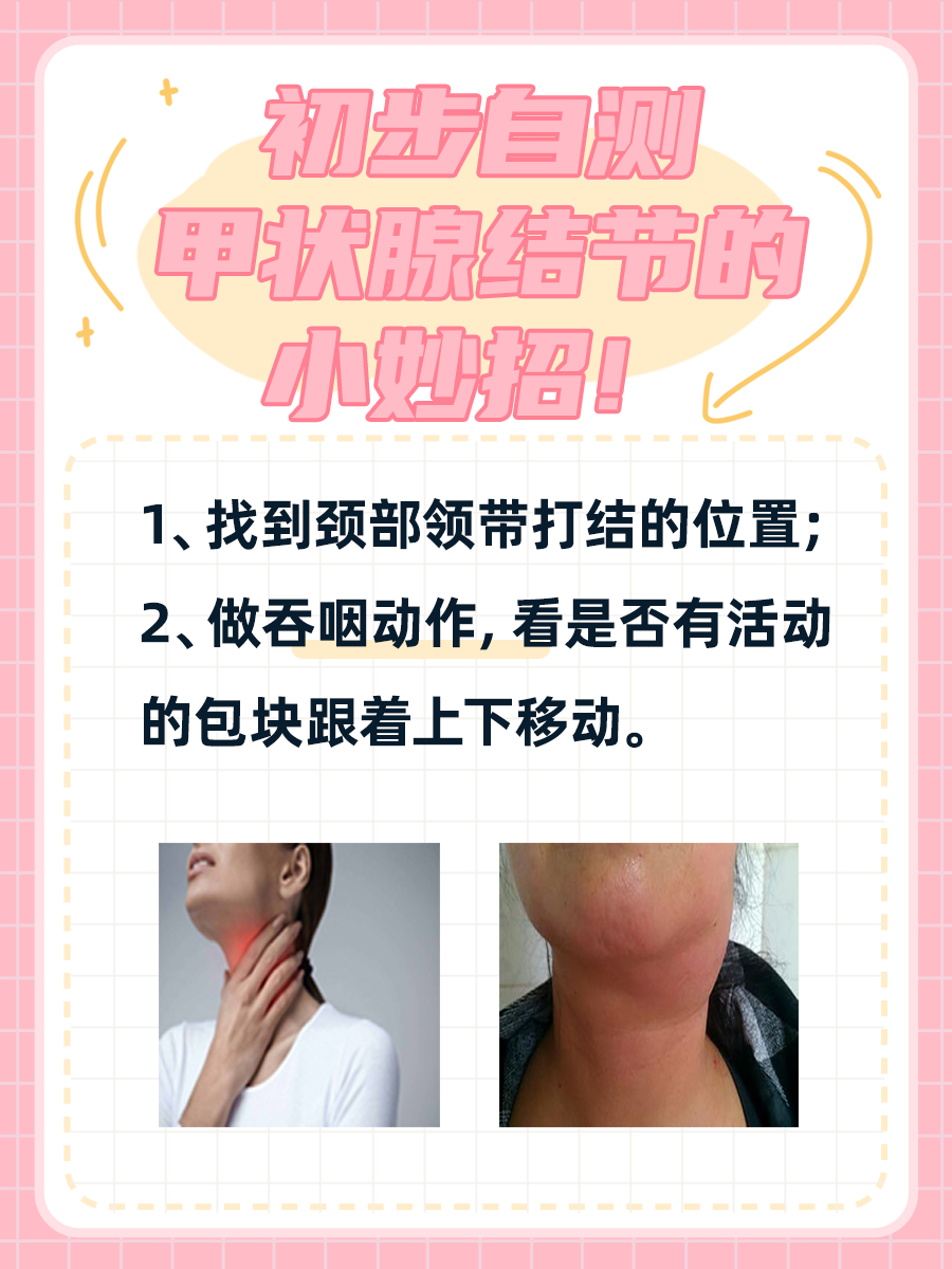 甲状腺结节怎么治疗合适?听听医生怎么说