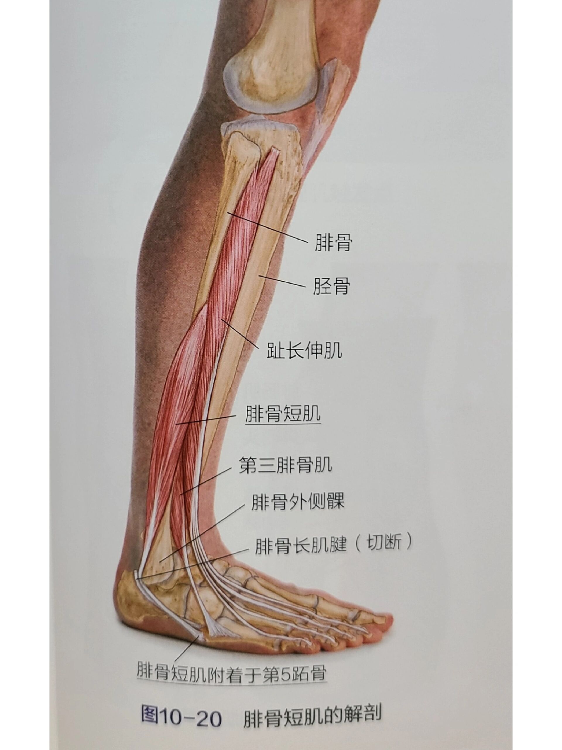 腓骨长肌痛图片