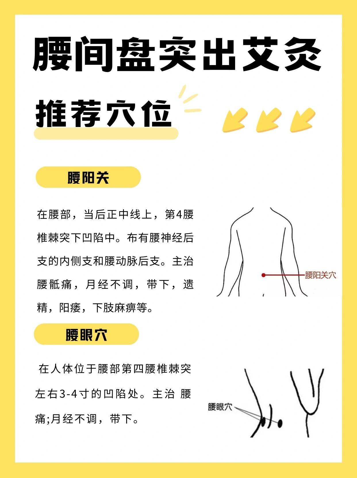 腰间盘突出怎么艾灸