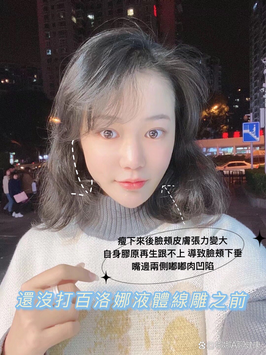 水光配方三文鱼77百洛娜液体线雕效果