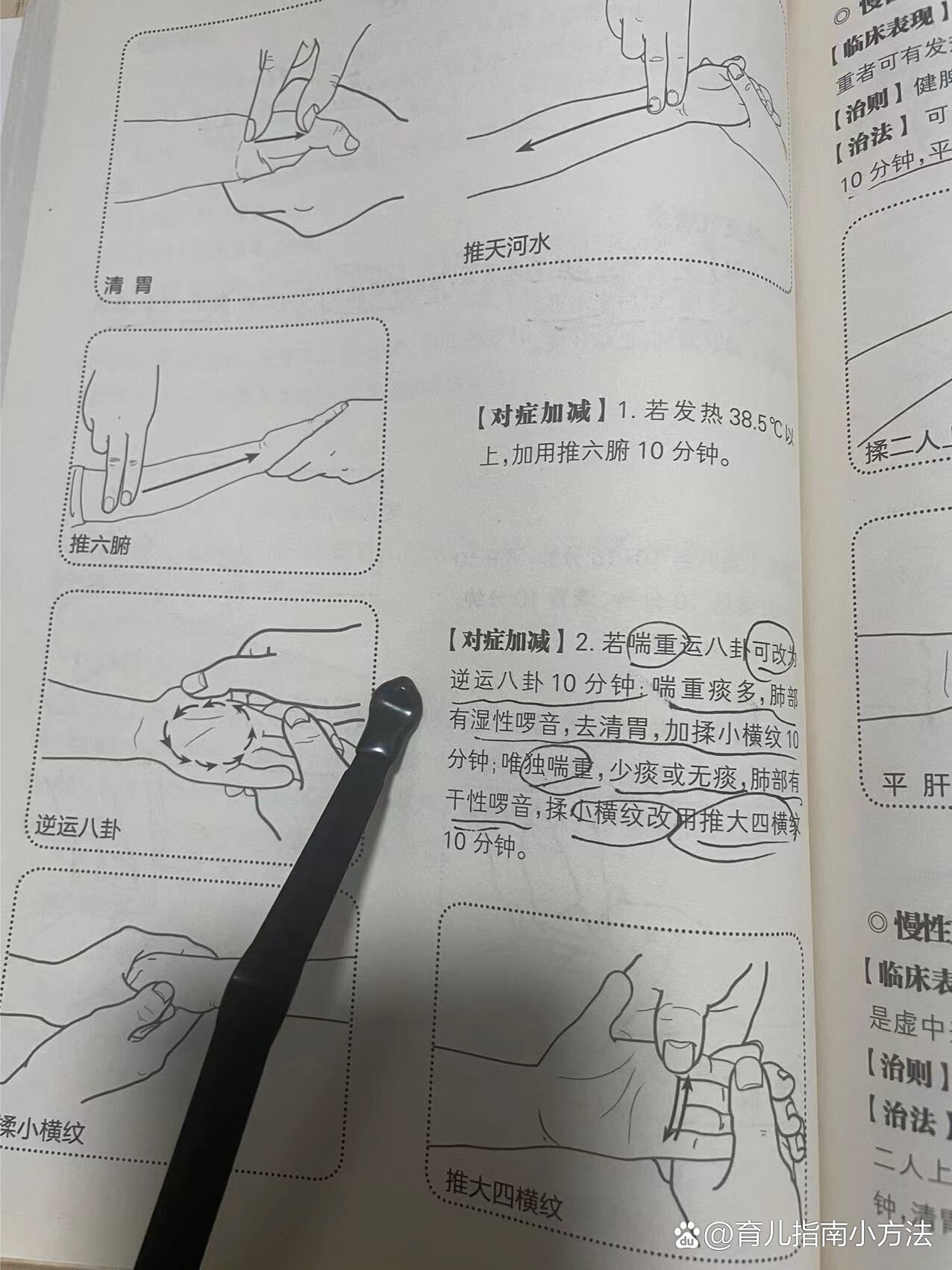 小孩子支气管炎自己在家做嘛推拿