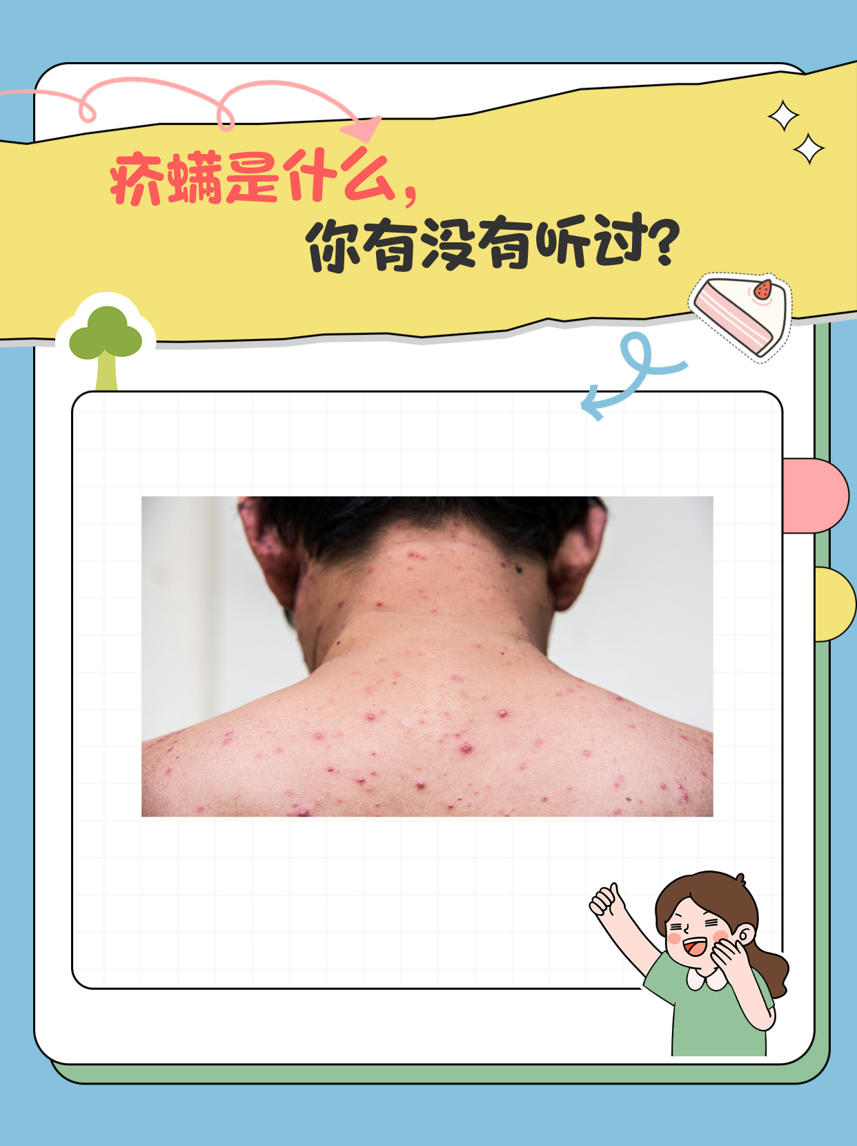 疥螨是什么,你有没有听过?