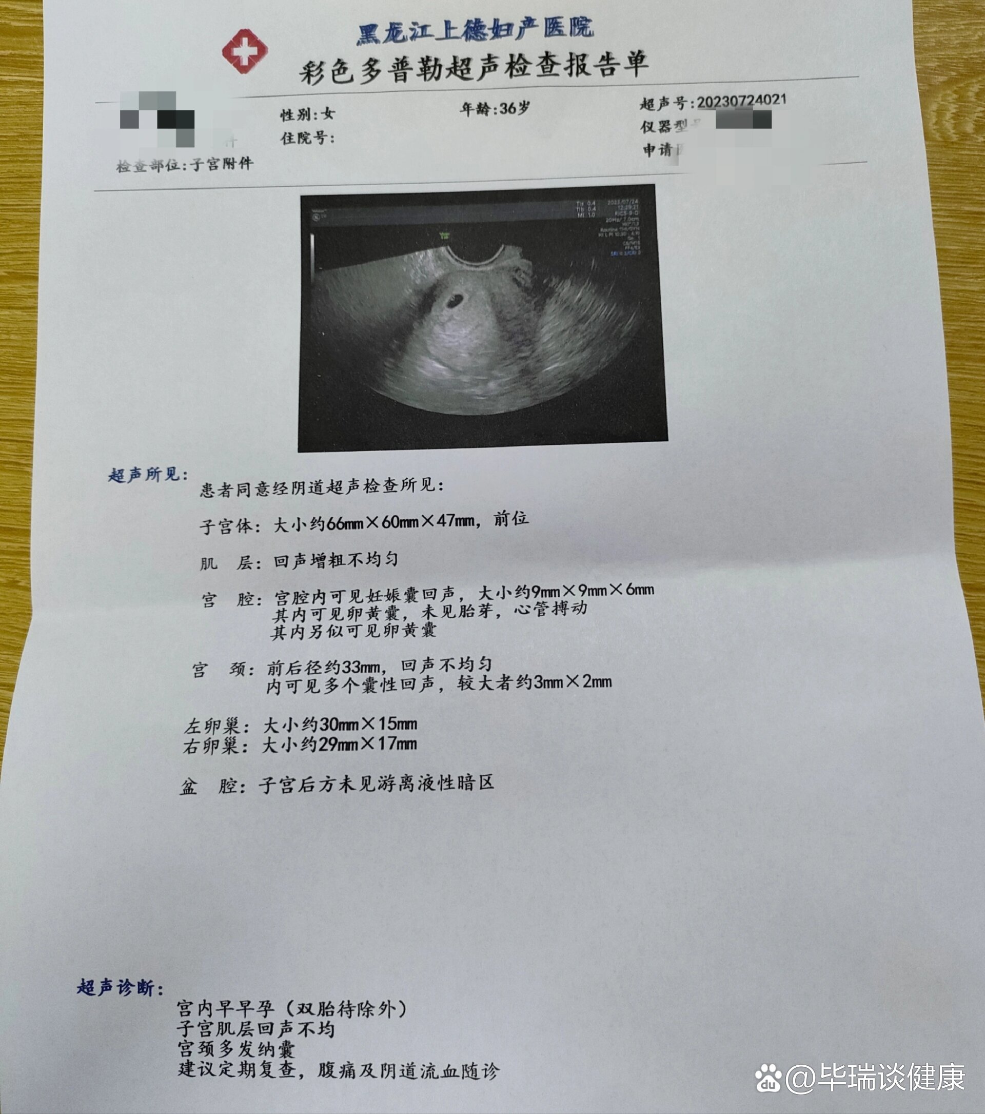 囊胚移植21天_囊胚移植21天hcg值多少属于正常