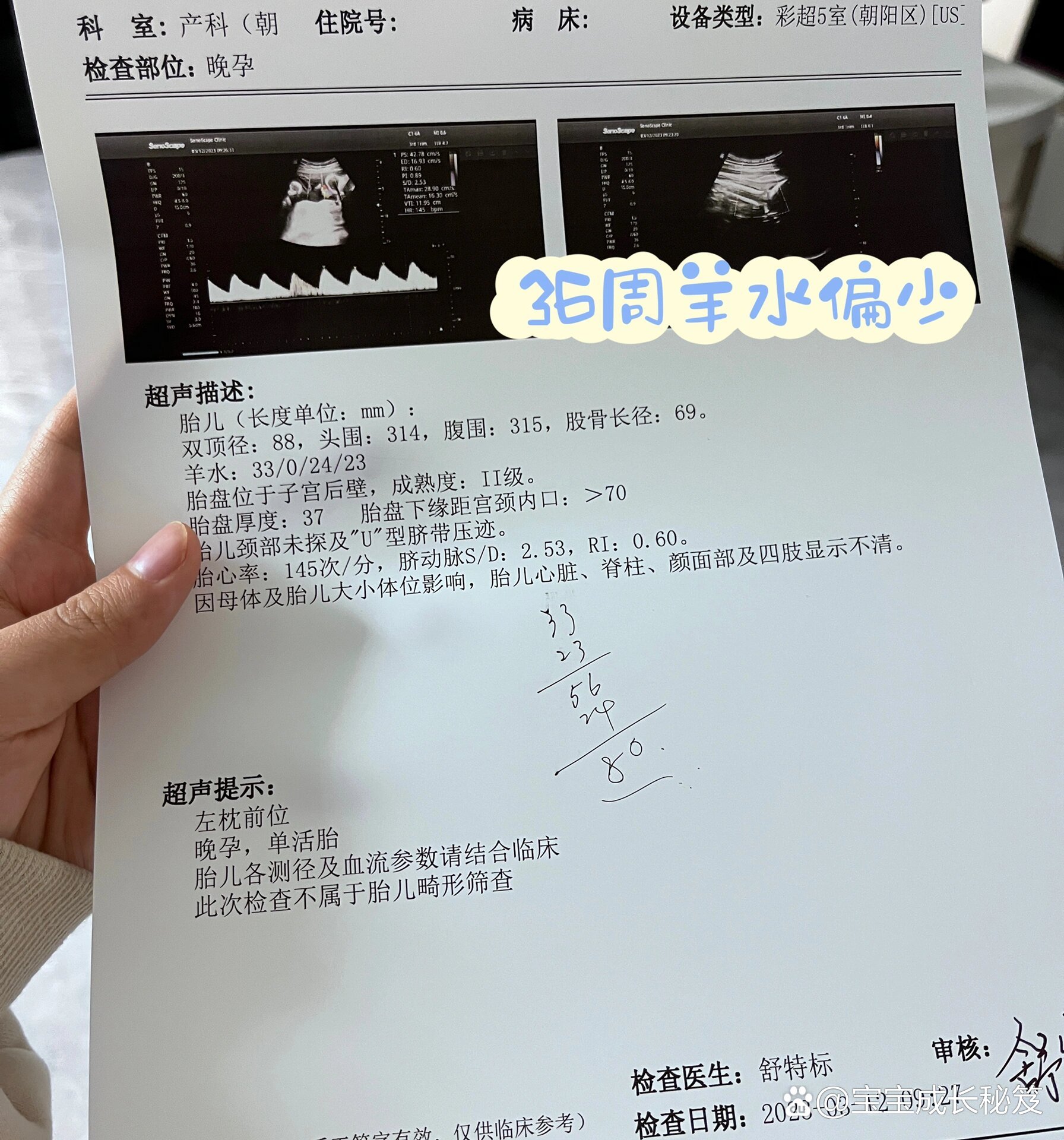 孕晚期羊水少一周逆转!