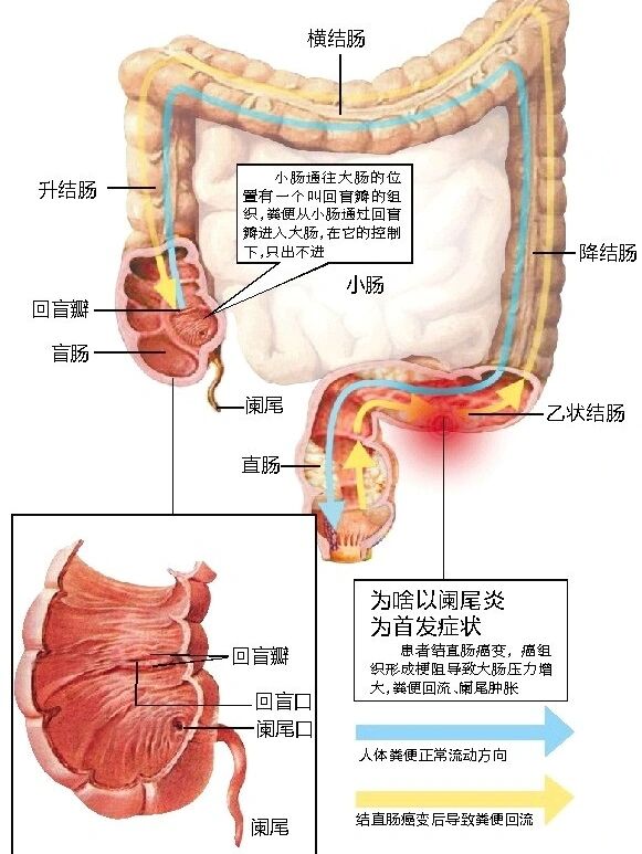 横结肠位置图片