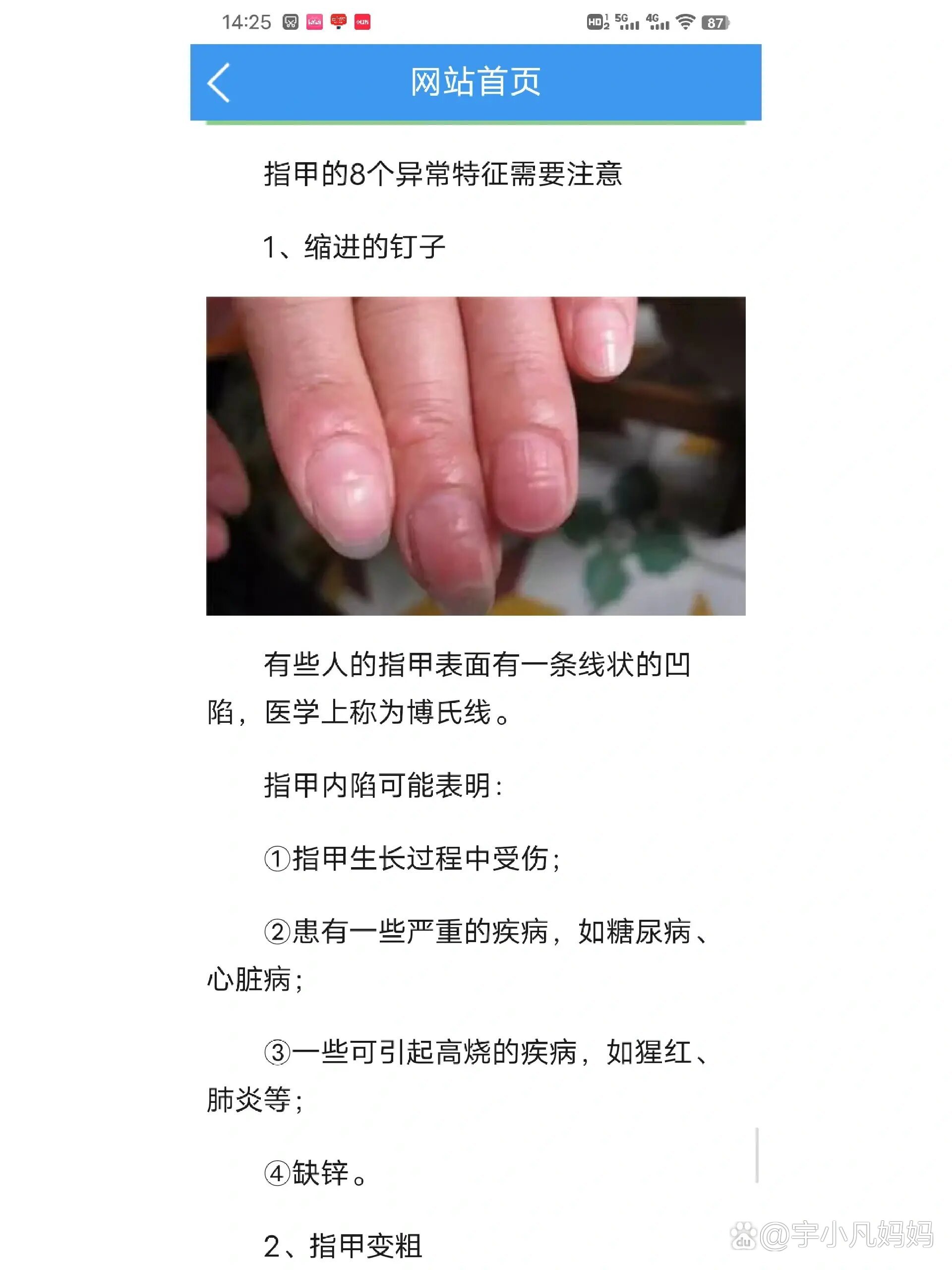 指甲凹陷的原因