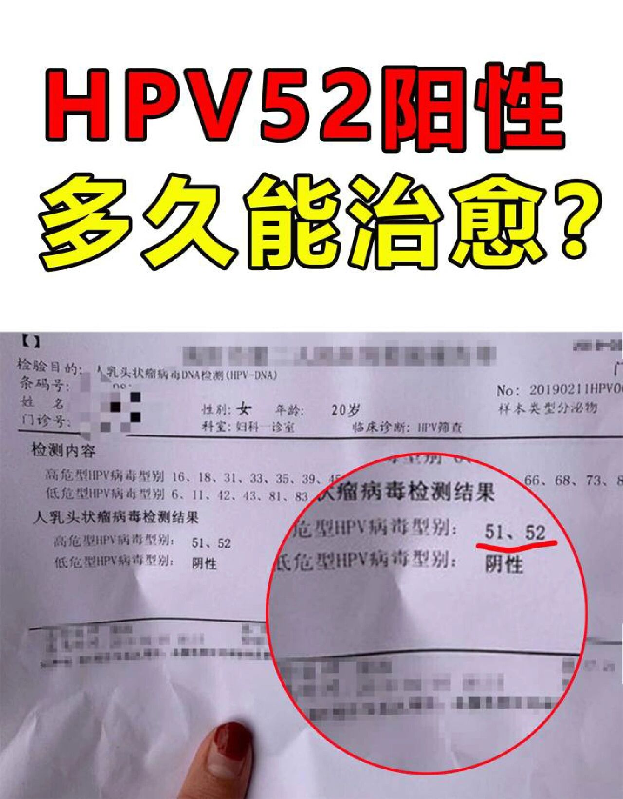 女人感染hpv52图片图片