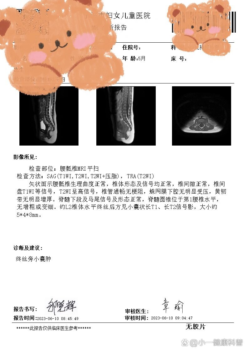 关于脊髓栓系(安全通过)