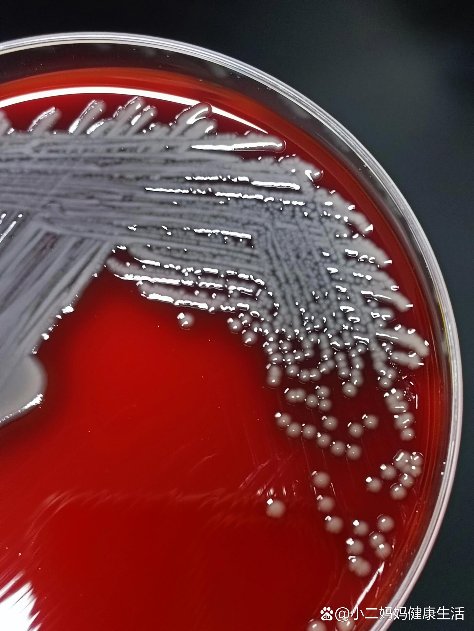 颗颗分明的杀鲑气单胞菌
