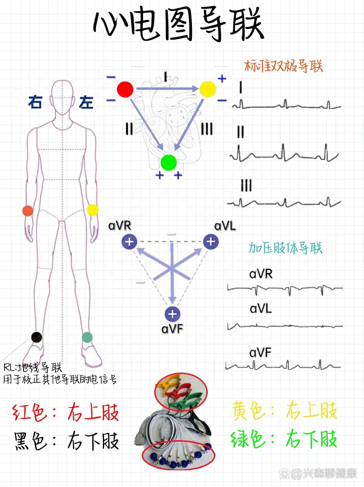 心电图6导联位置口诀图片