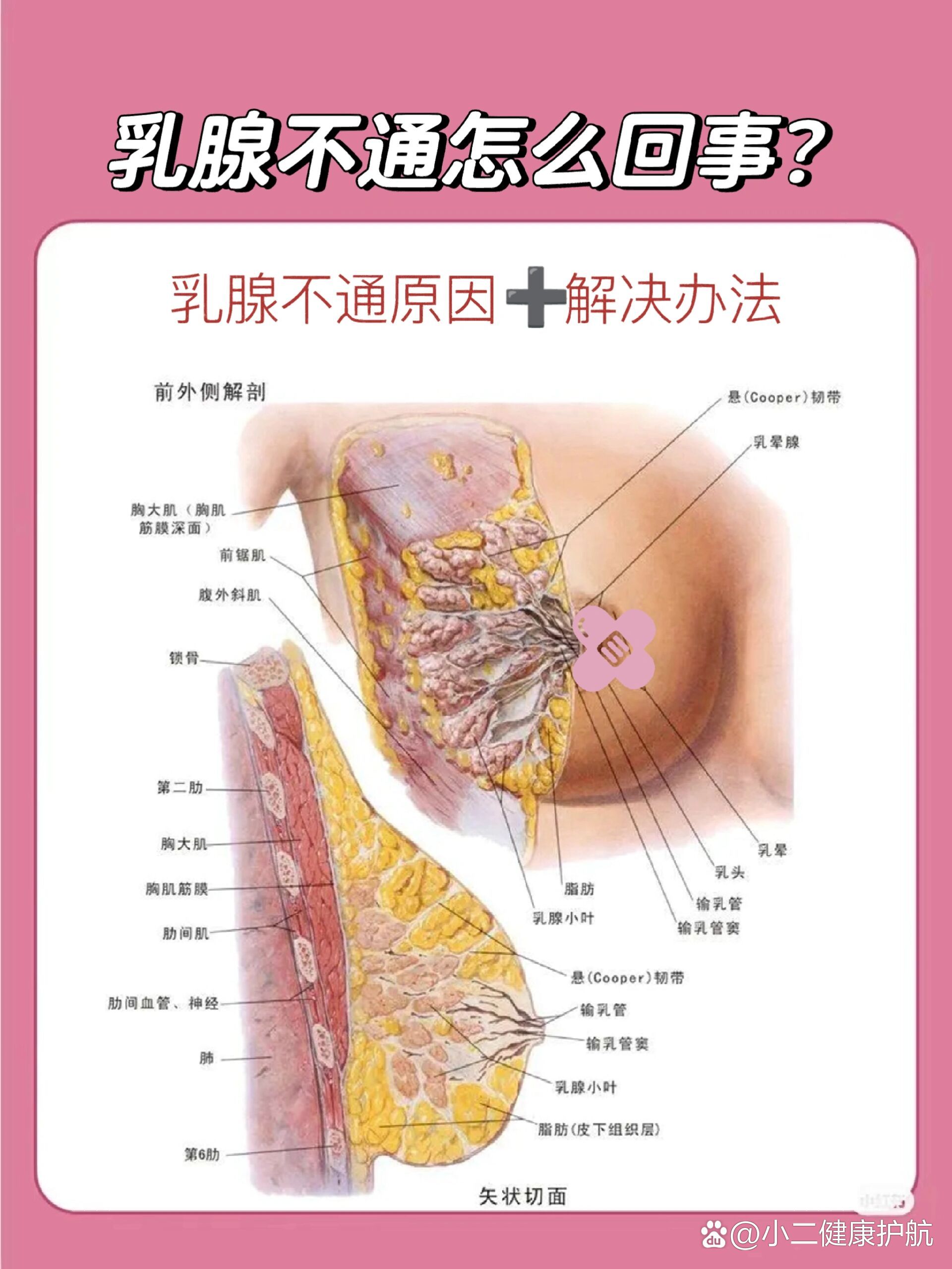 乳晕腺图片