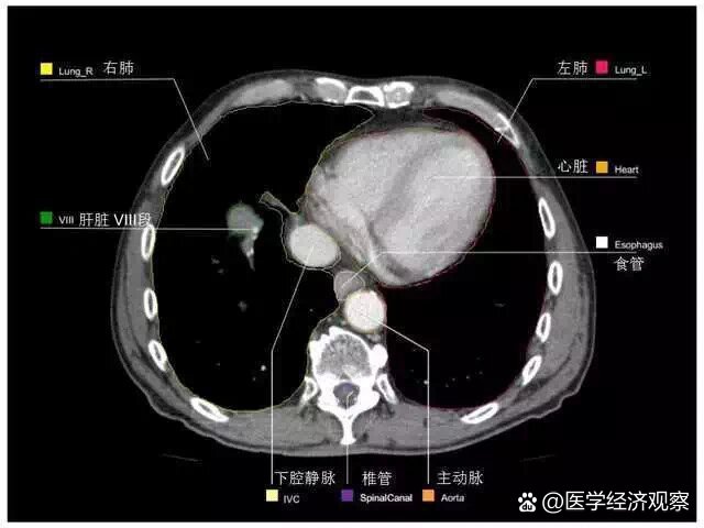 全腹部ct影像高清实用图谱11566