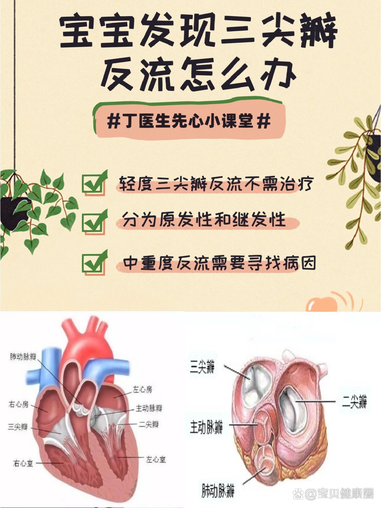 三尖瓣关闭不全图片