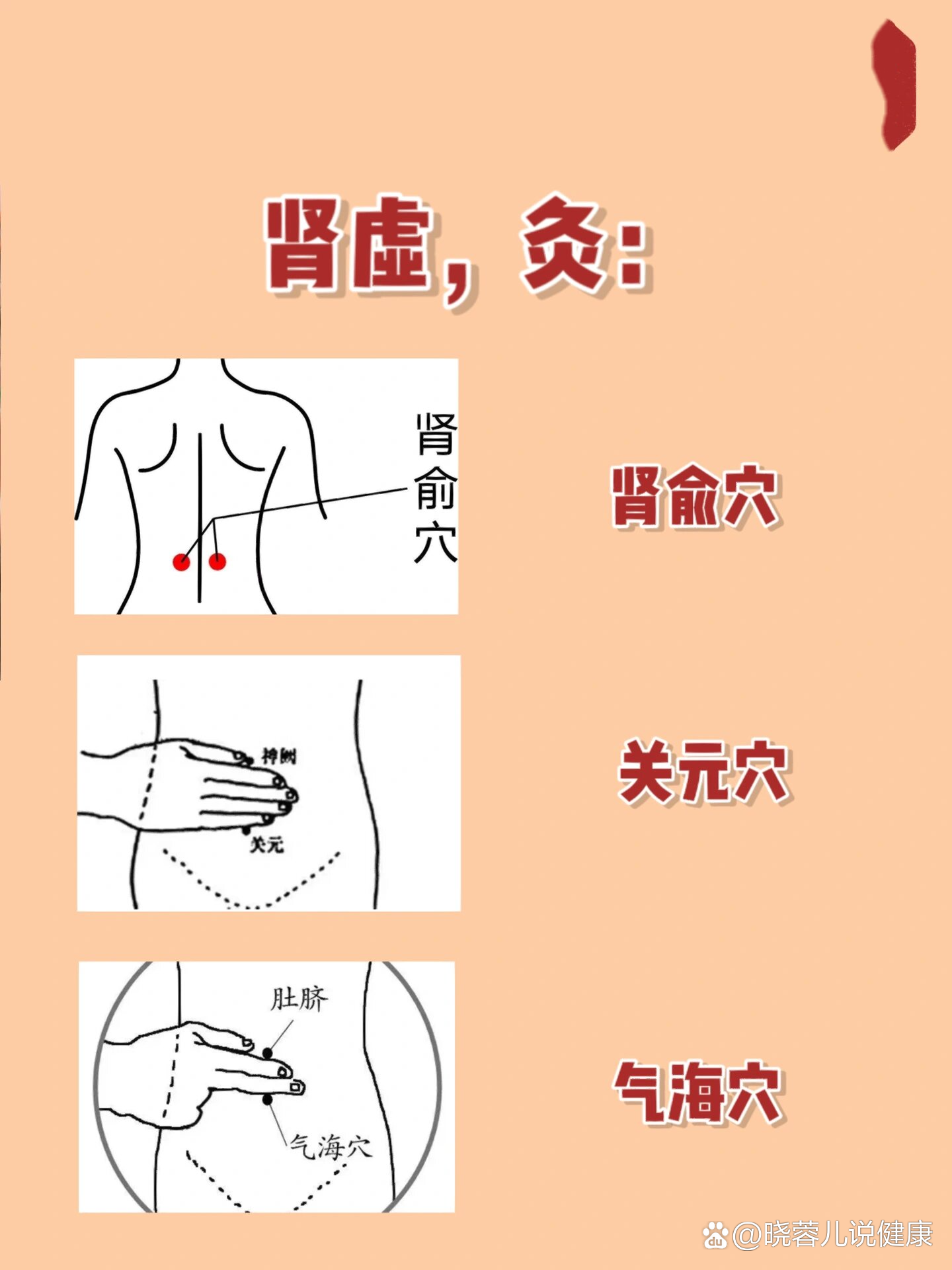 女性也要养肾6015肾虚艾灸这几个穴位