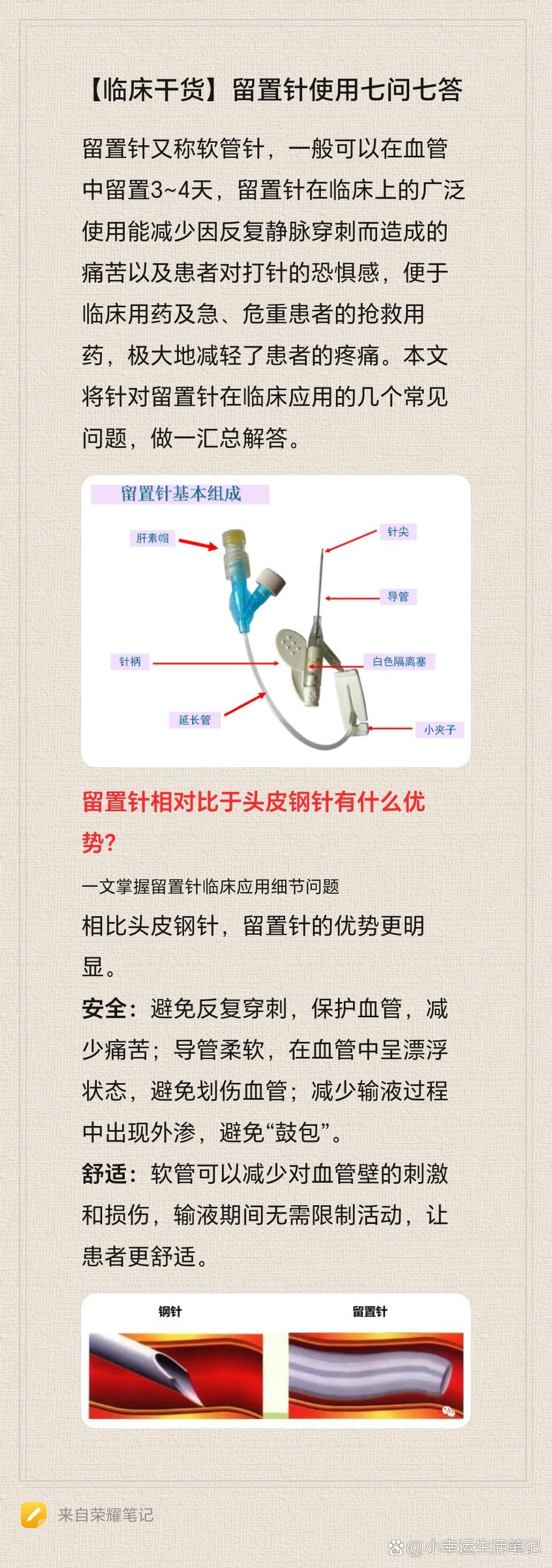 林华正压留置针图片图片