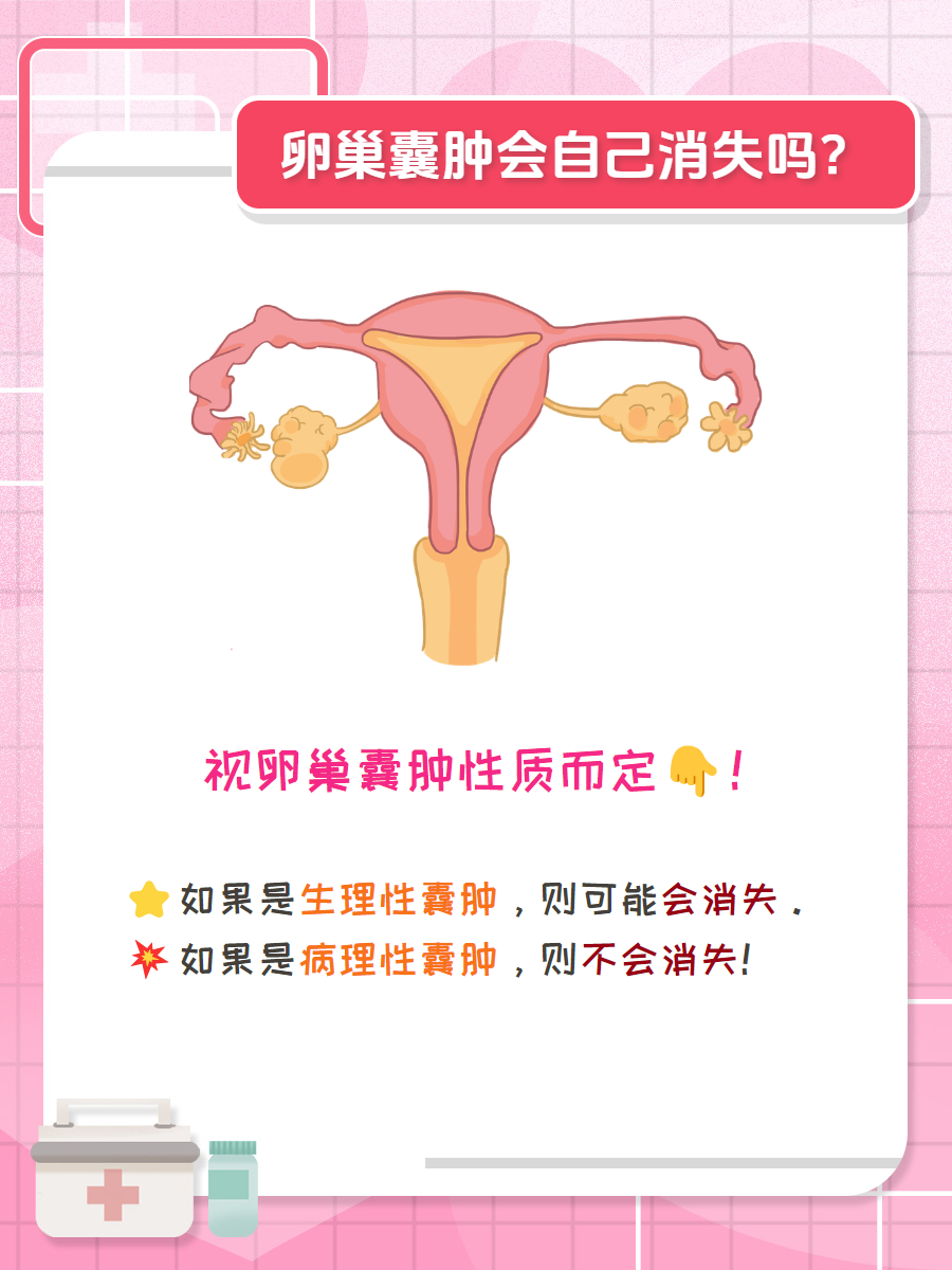 卵巢囊肿可能会自己"消失"?真相来了!