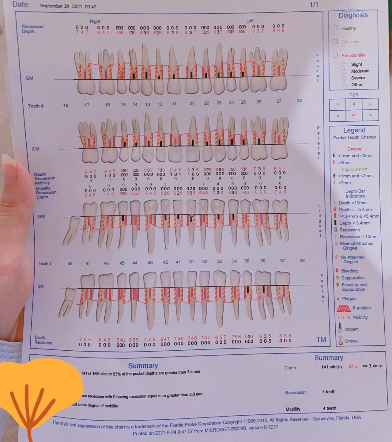 牙周探针刻度示意图图片