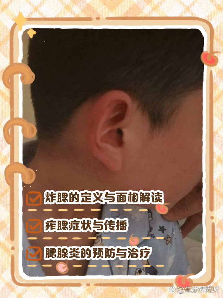 炸腮的解析与预防