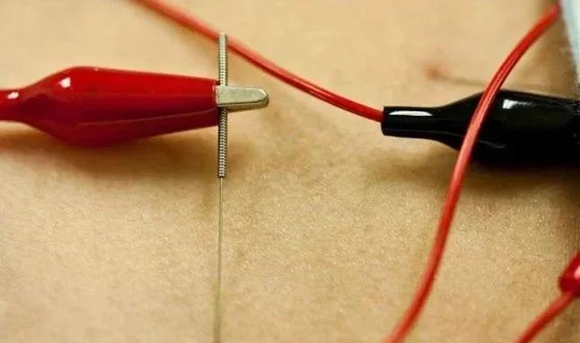 电针使用指南：从零开始到熟练操作