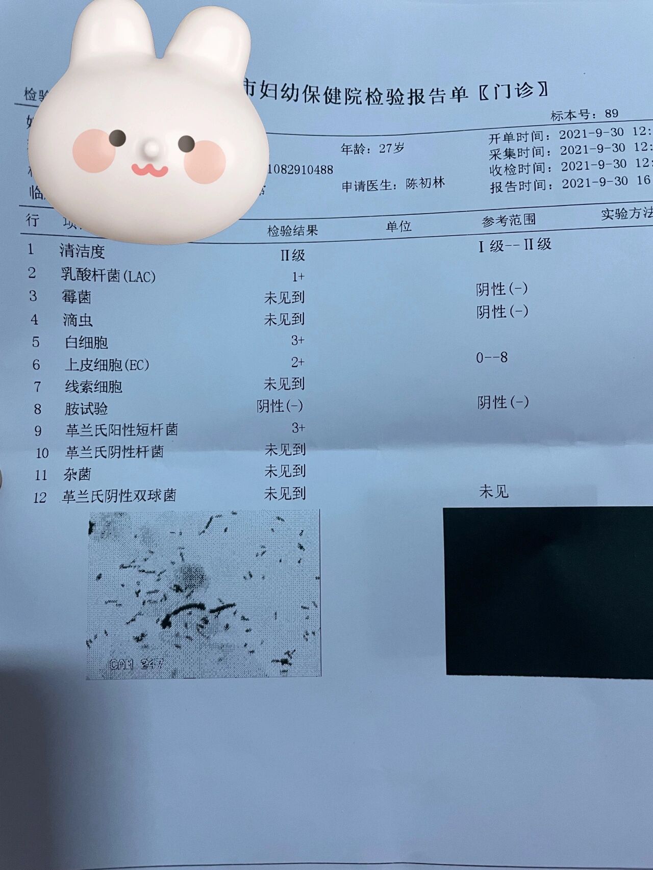 白带脓状发黄怎么回事图片