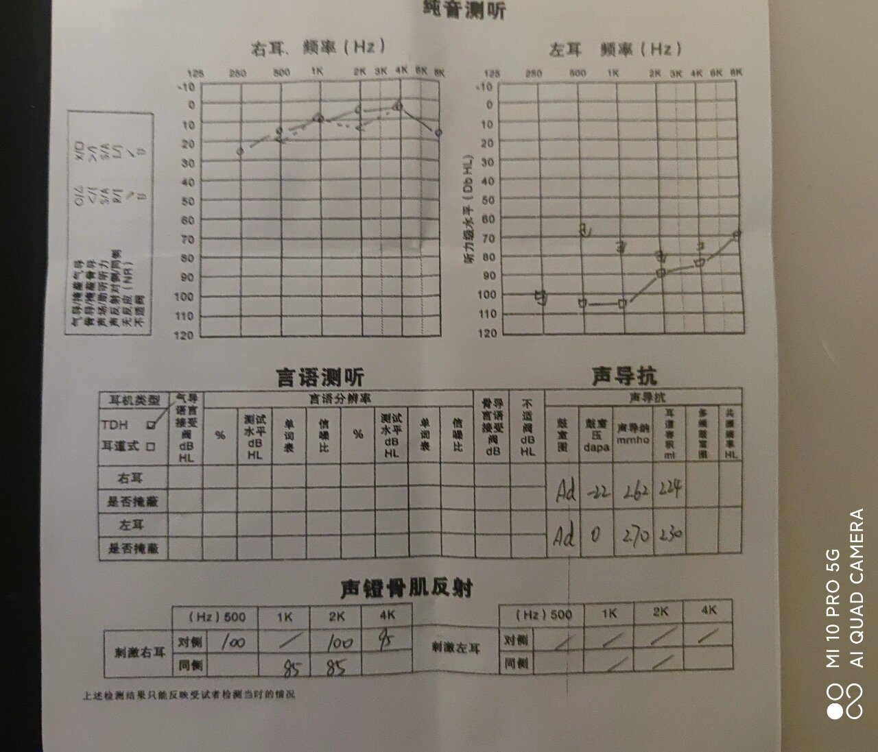 突发性耳聋的康复和治疗〔一
