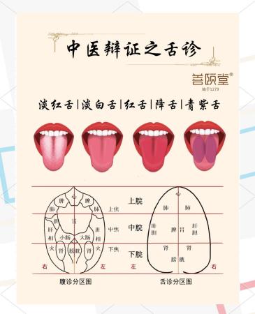 中医舌诊：辨别健康与疾病的关键