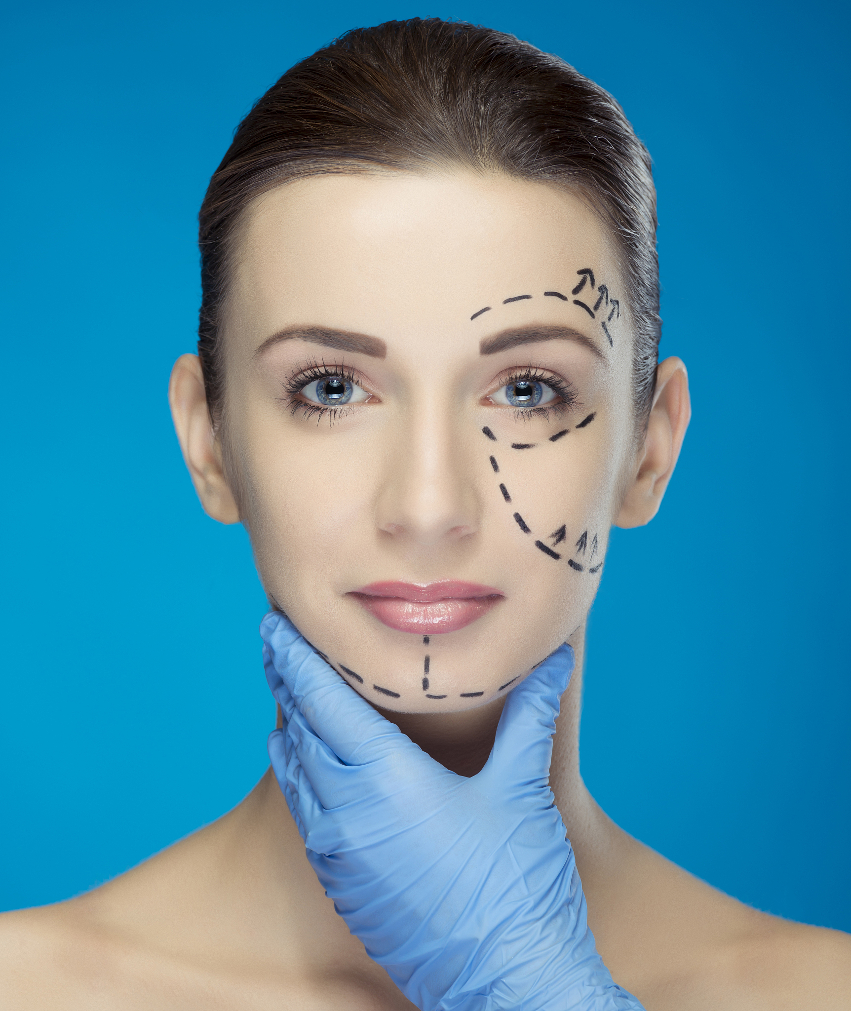 医美下颌角整形,让你时刻展露完美下巴